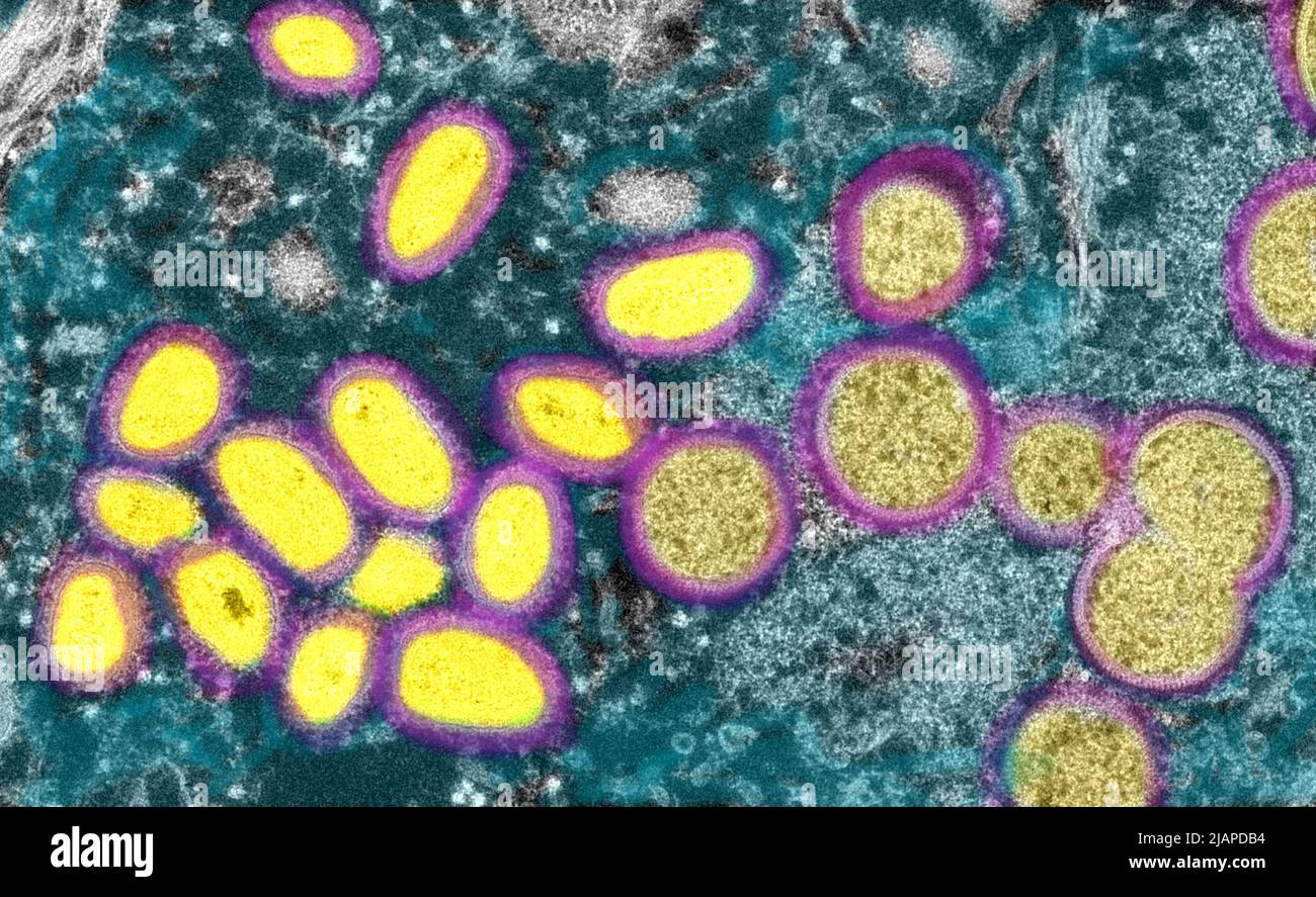 Cette image microscopique électronique (EM) a représenté un virion de la variole du singe, obtenu à partir d'un échantillon clinique associé à l'éclosion de chien de prairie de 2003. Il s'agissait d'une image de coupe mince d'un échantillon de peau humaine. À gauche se trouvaient des particules de virus matures de forme ovale, et à droite, des croissants et des particules sphériques de virions immatures. Une version optimisée et améliorée d'une image produite par les Centers for Disease Control and Prevention des États-Unis / Credit CDC /C.S. Goldsmith ; R.Regnery 2003. Rendu des couleurs erroné Banque D'Images