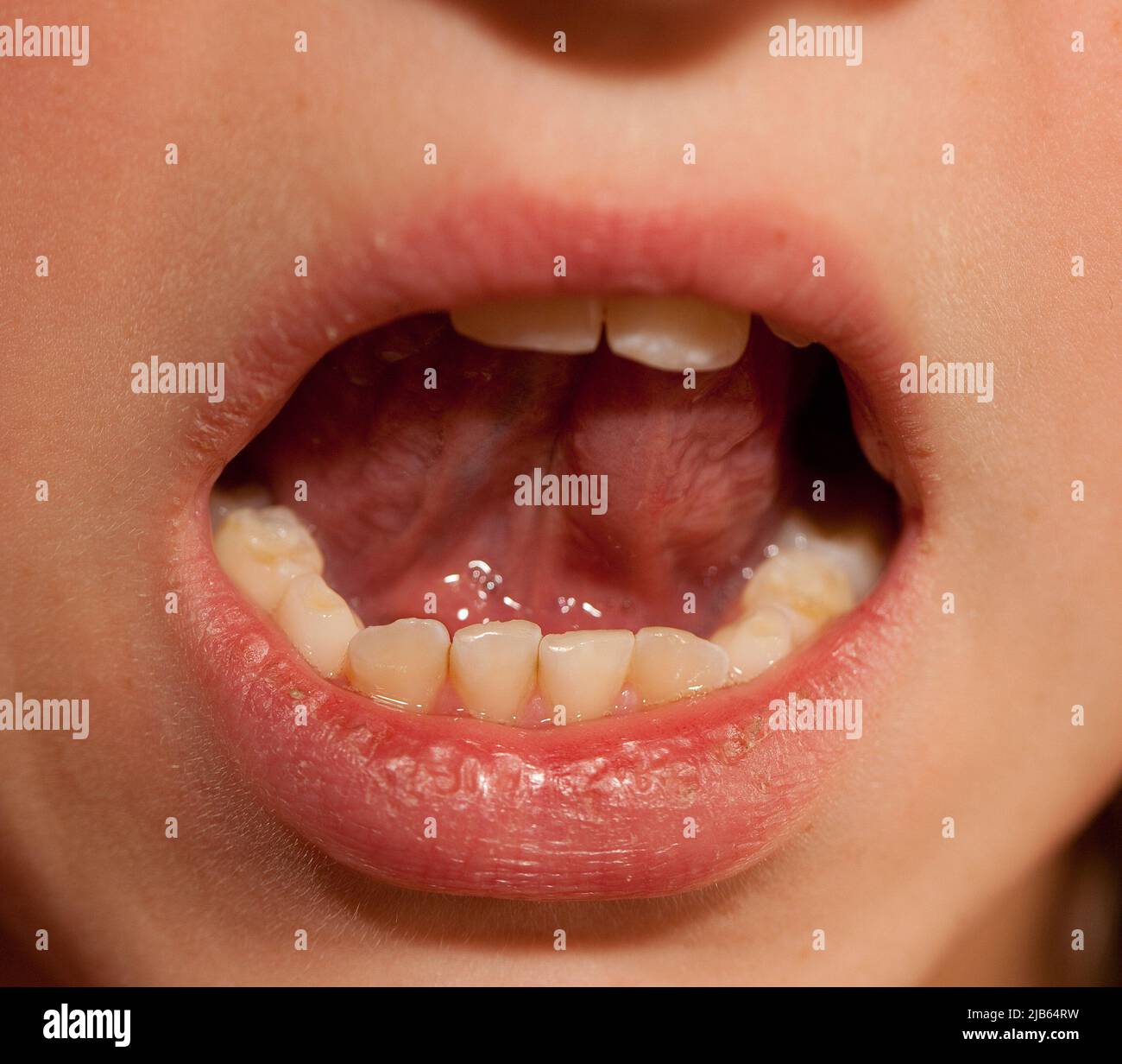 Pays-Bas, la bouche d'un garçon sourd qui prononce les mots ainsi la lipreading est possible. Banque D'Images