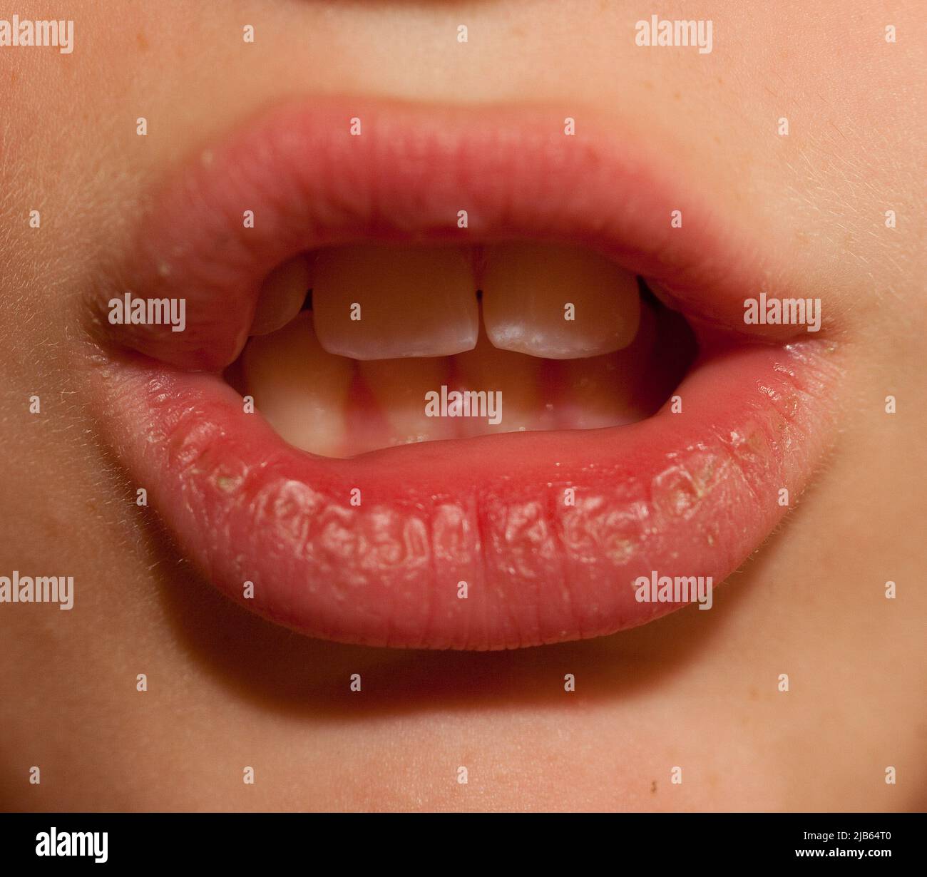 Pays-Bas, la bouche d'un garçon sourd qui prononce les mots ainsi la lipreading est possible. Banque D'Images
