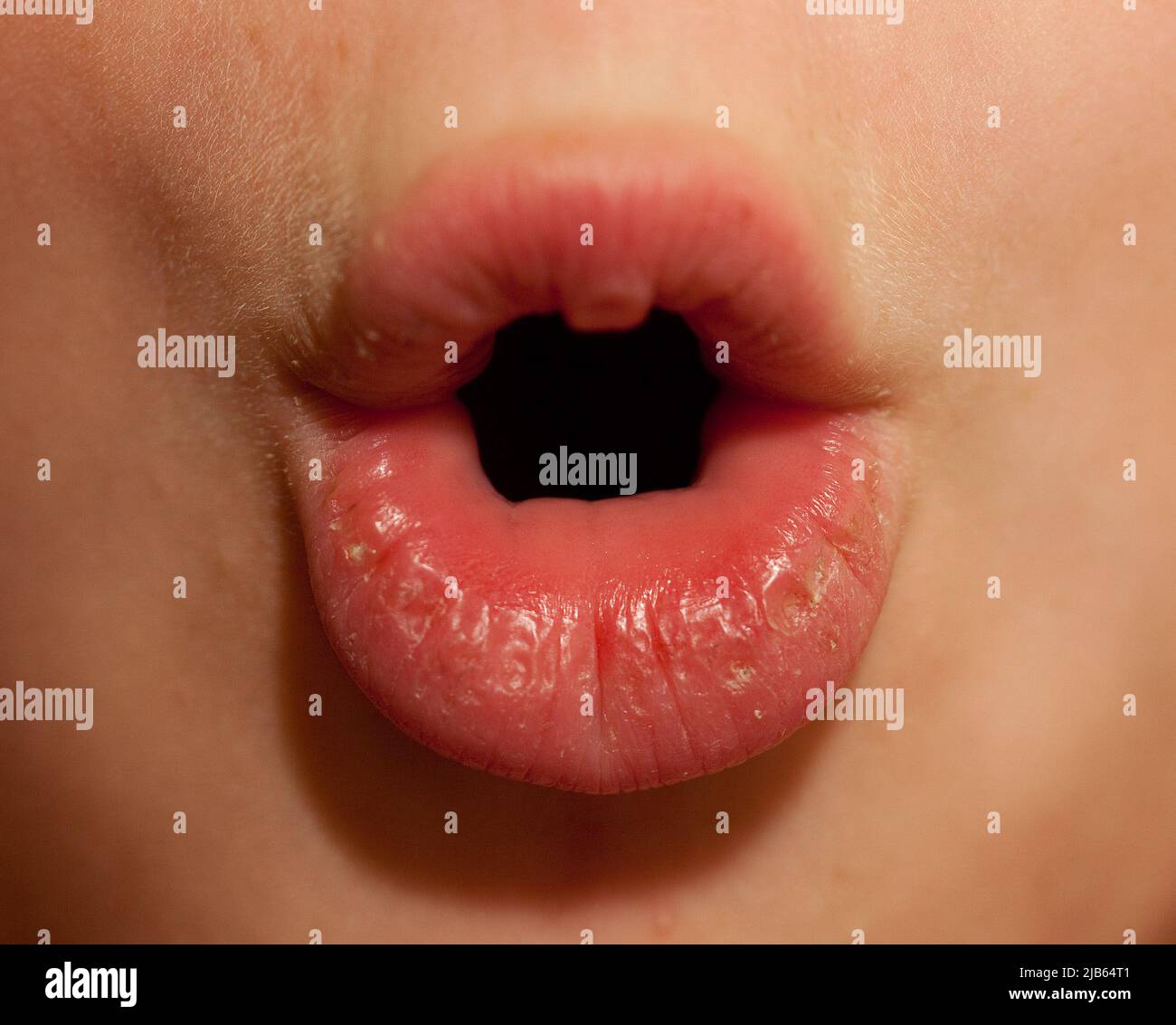 Pays-Bas, la bouche d'un garçon sourd qui prononce les mots ainsi la lipreading est possible. Banque D'Images