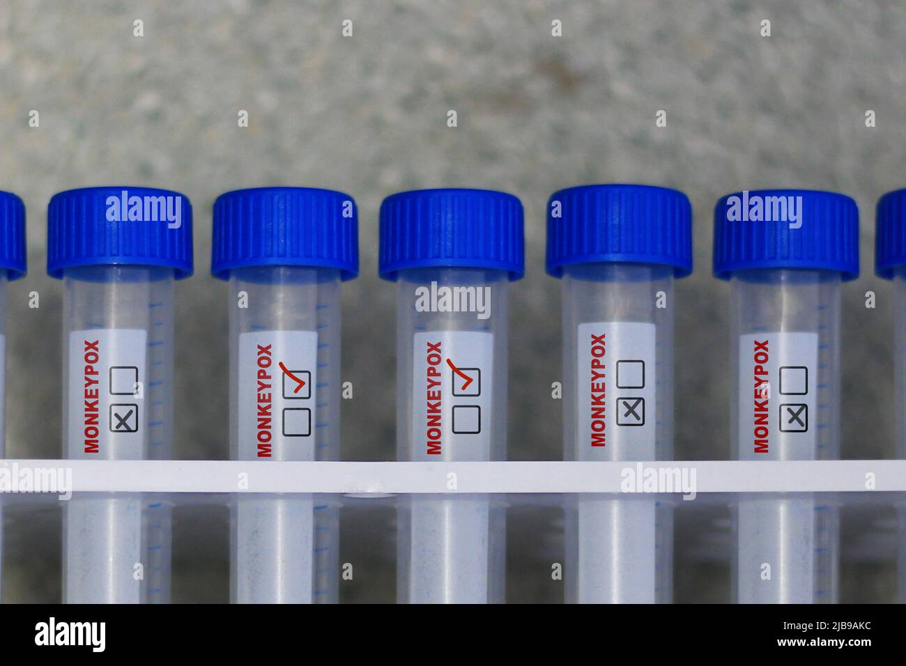 Le tube de laboratoire montre le virus de la variole du singe Banque D'Images