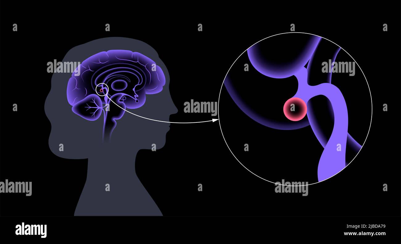 Presse-étoupe pinéal, illustration Banque D'Images