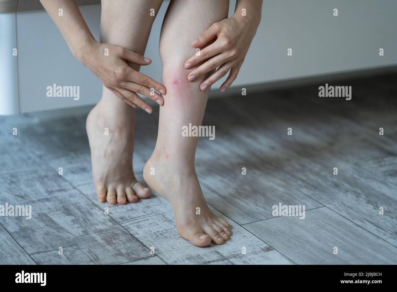 Une femme asiatique touche sa jambe après avoir été piquée par un moustique à la maison souffrant d'une réaction allergique Banque D'Images