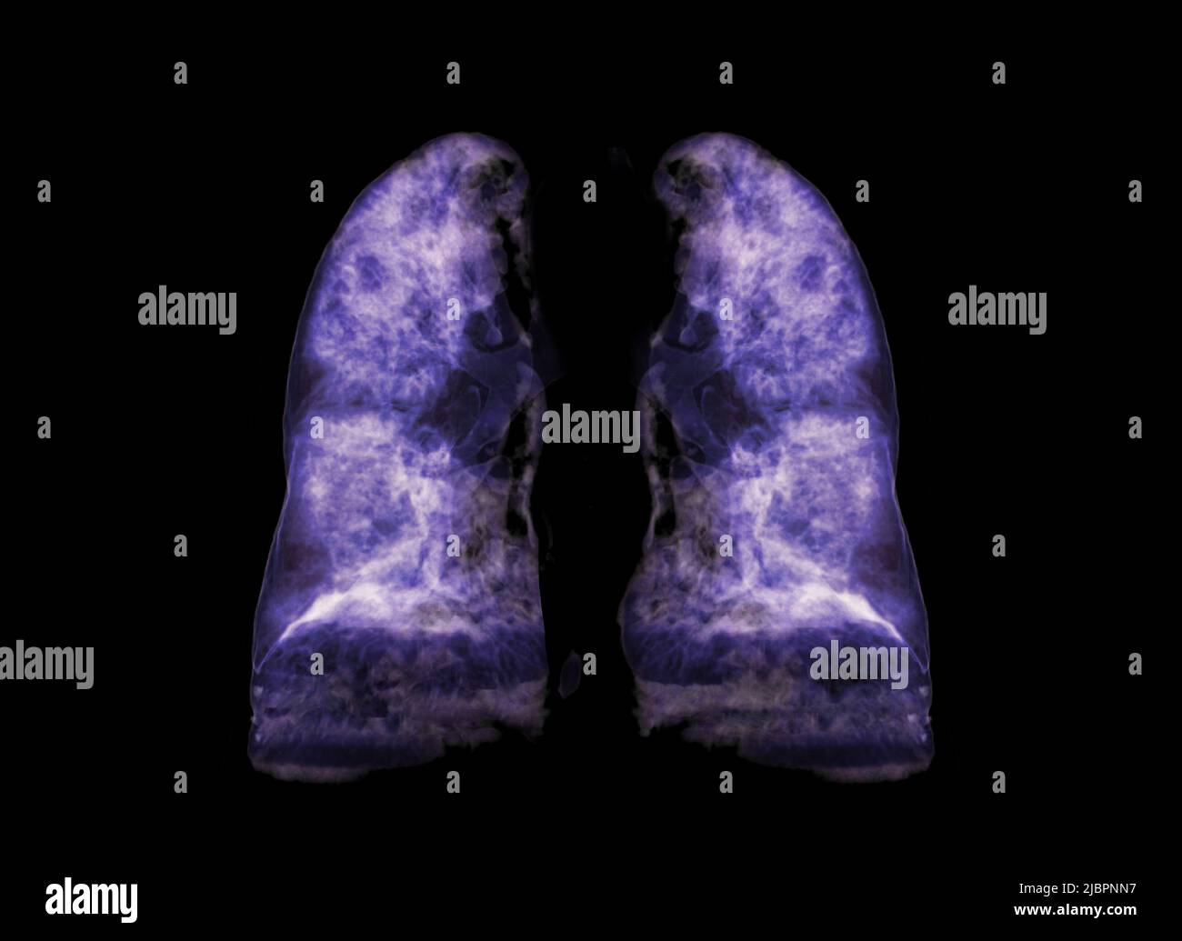 Image de rendu poumon 3D pour le diagnostic TB, tuberculose et Covid-19 à partir du scanner CT-scanner 3D. Banque D'Images