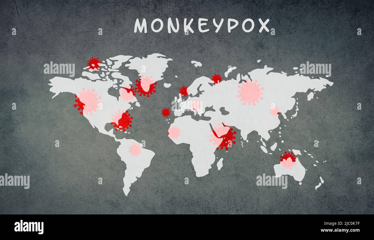 Carte du monde, la monkeypox est debout sur le fond texturé, l'épidémie du virus MPXV, la propagation de maladies infectieuses, la pandémie Banque D'Images
