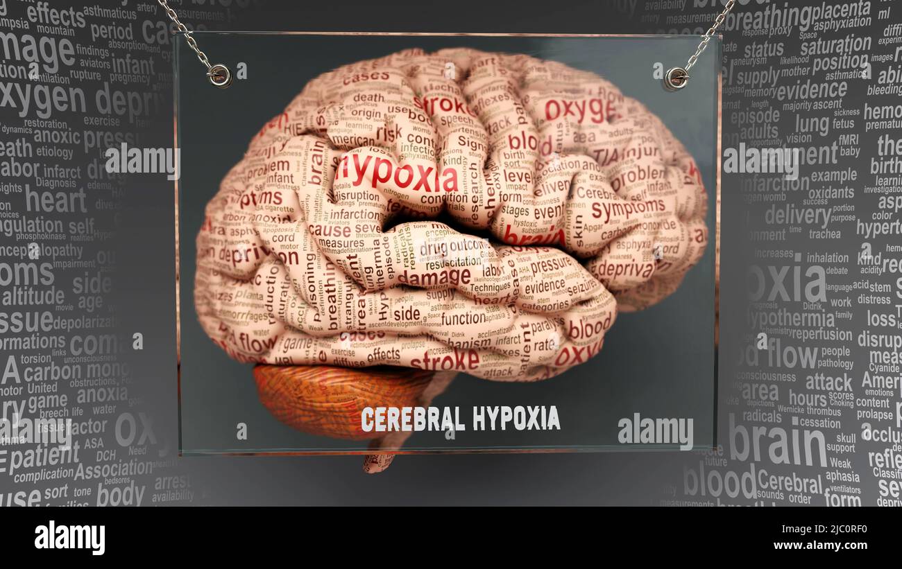 Hypoxie cérébrale dans le cerveau humain - des dizaines de termes décrivant ses propriétés peintes sur le cortex cérébral pour symboliser sa connexion à l'esprit.,3D Banque D'Images Hypoxie cérébrale dans le cerveau humain - des dizaines de termes décrivant ses propriétés peintes sur le cortex cérébral pour symboliser sa connexion à l'esprit.,3D Banque D'Images
