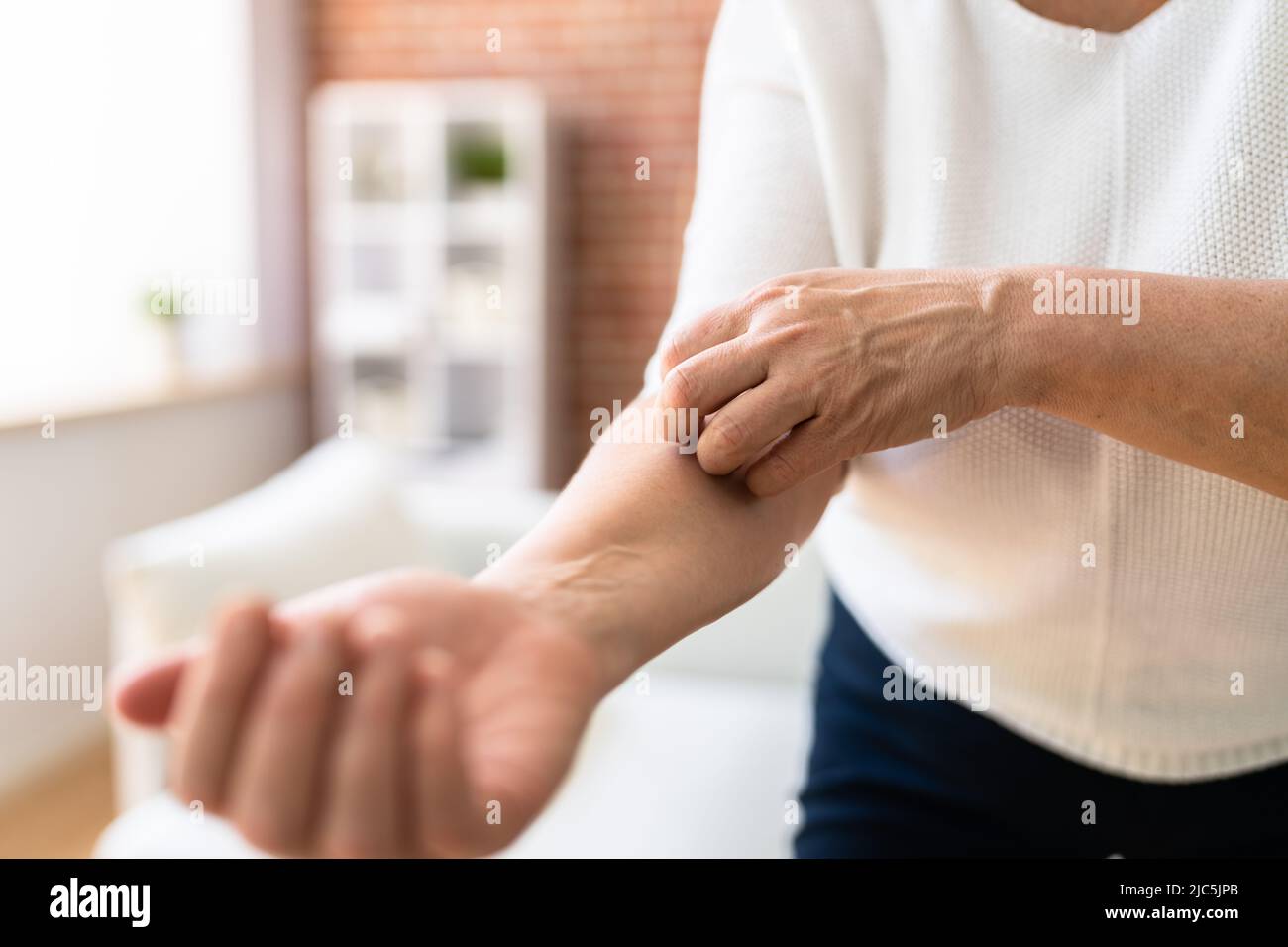 Femme rayant la peau du corps avec des allergies Banque D'Images