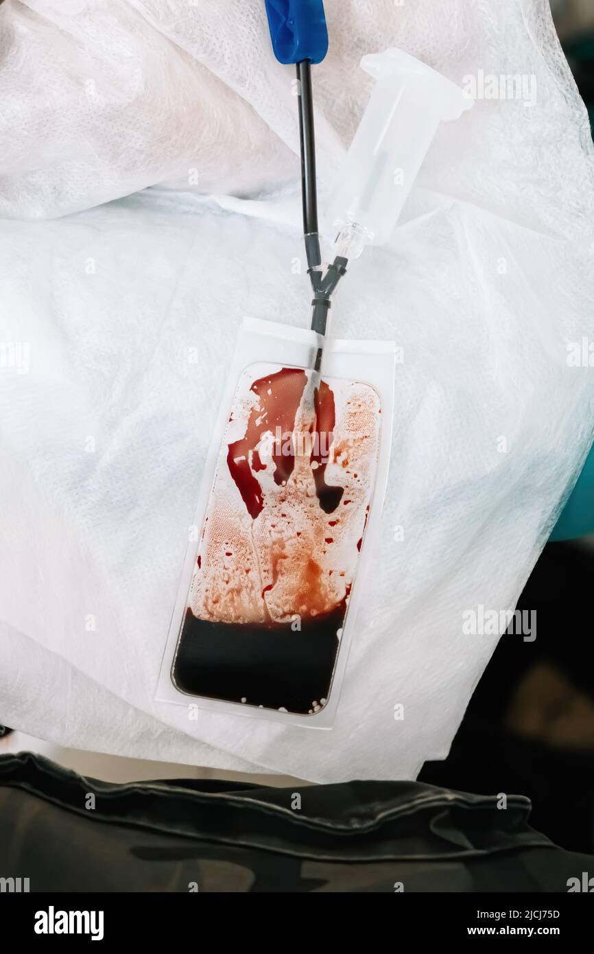 Poche de sang en laboratoire médical. Journée internationale du don de sang. Le donneur fait don de sang pour sauver la vie. Transfusion sanguine. Banque D'Images