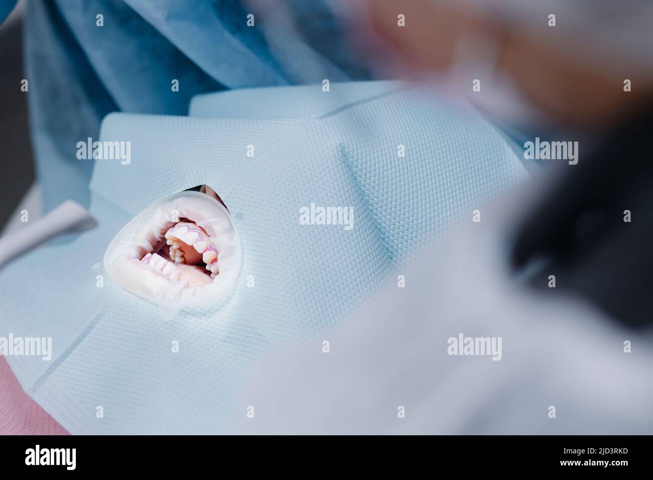 Dents blanches du patient avant l'intervention dans le cabinet dentaire. Photo de haute qualité Banque D'Images Dents blanches du patient avant l'intervention dans le cabinet dentaire. Photo de haute qualité Banque D'Images