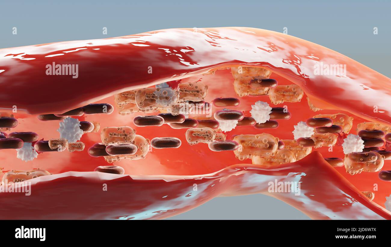 Pandémie d'infection à Monkeypox. cellule de monkeypox, symptômes ou précautions, variante de la variole, singe de fièvre muté, menace de virus pour la santé humaine, sang Banque D'Images