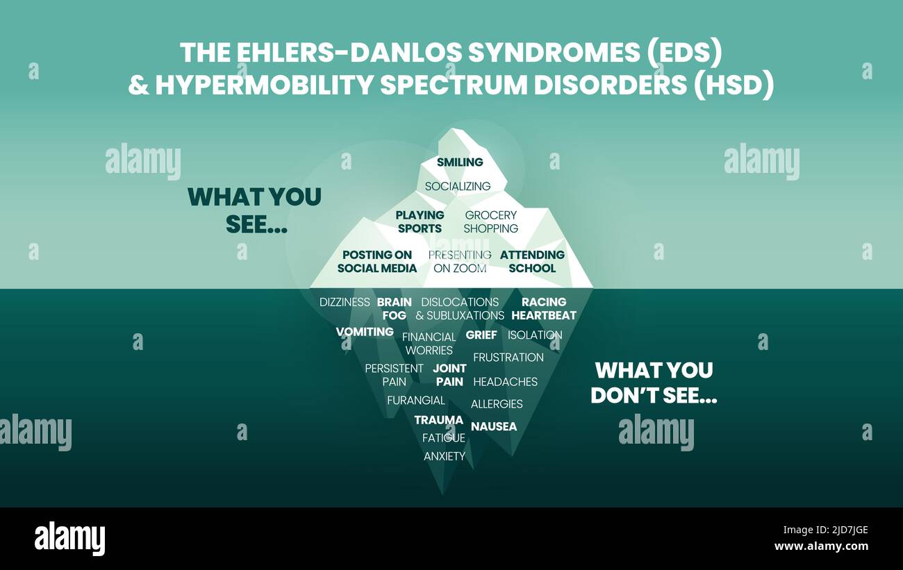 Le modèle iceberg des syndromes d'Ehlers-Danlos (EDS) et le concept de trouble du spectre d'hypermobilité (HDS) a le symptôme de surface peut voir heureux et normal Illustration de Vecteur
