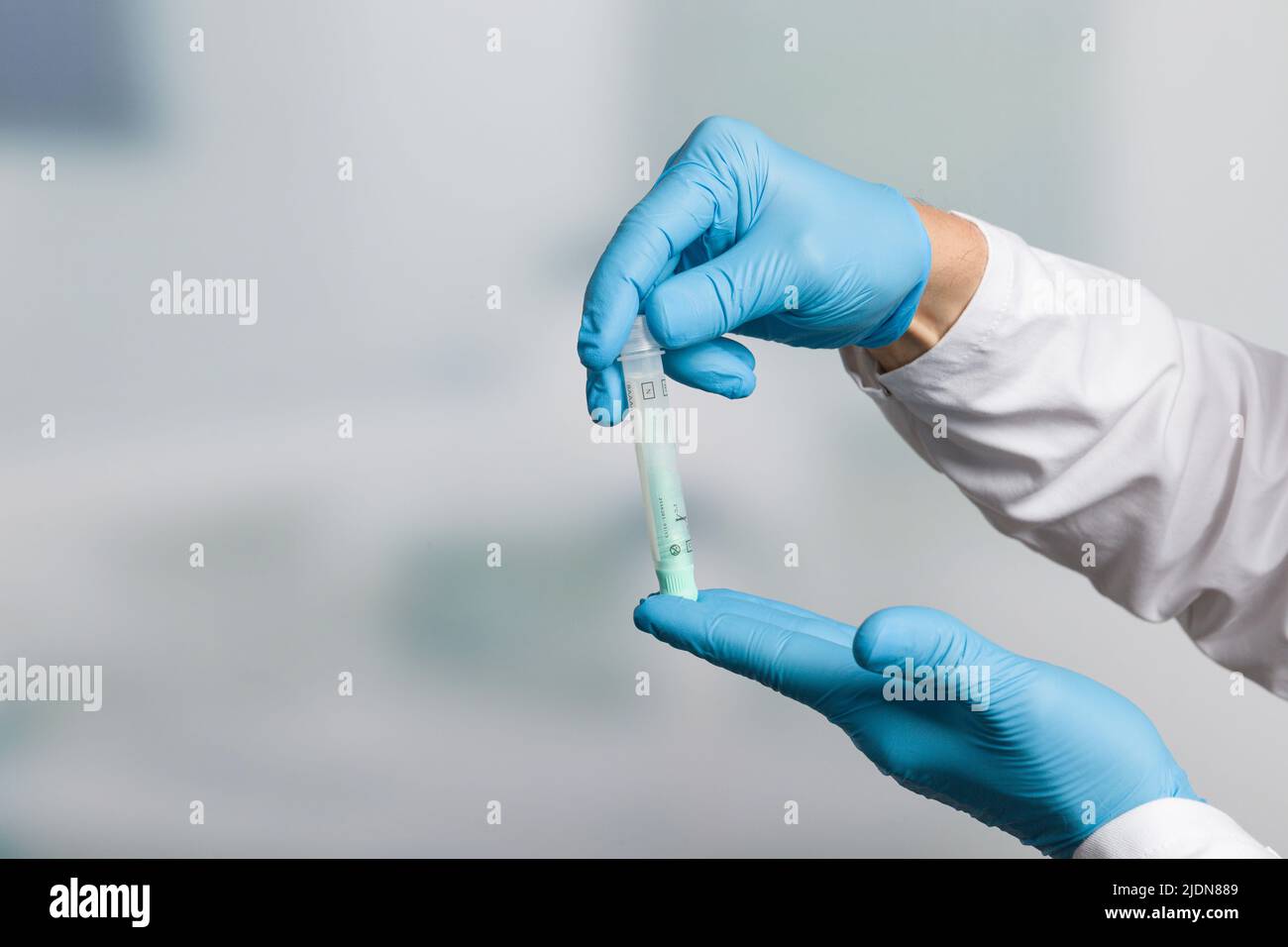 Main du médecin avec un tube à essai pour l'échantillon de selles pour le dépistage du cancer du côlon Banque D'Images