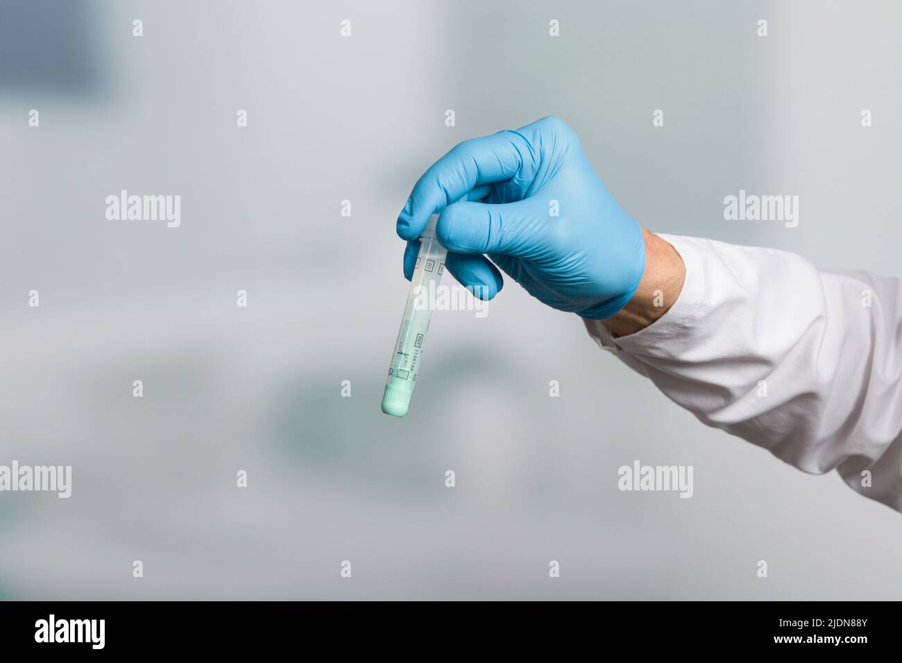 Main du médecin avec un tube à essai pour l'échantillon de selles pour le dépistage du cancer du côlon Banque D'Images