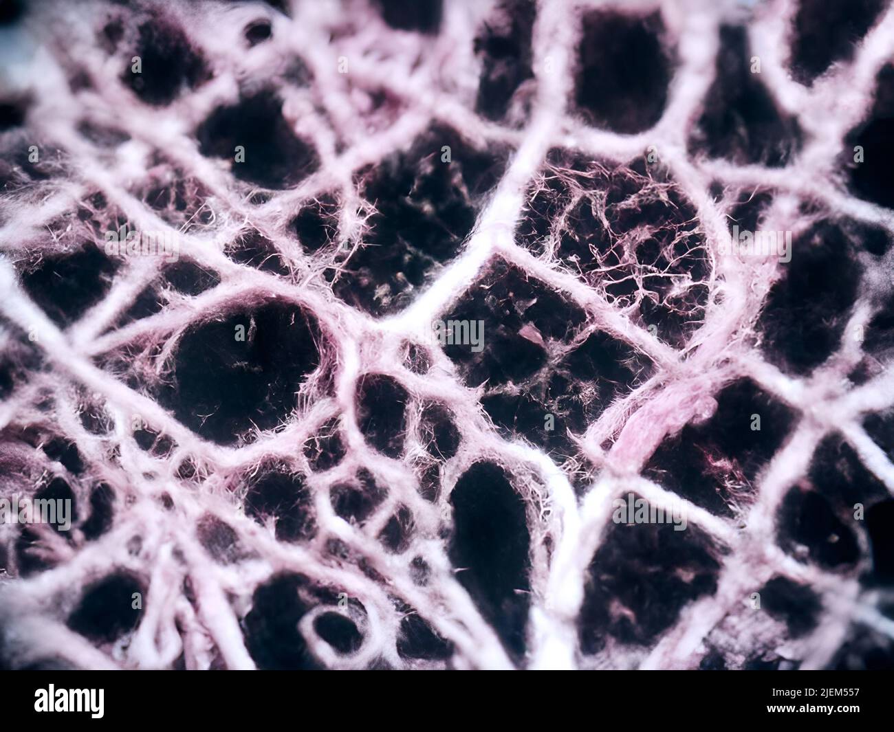 Tissu pulmonaire sous le microscope Banque D'Images