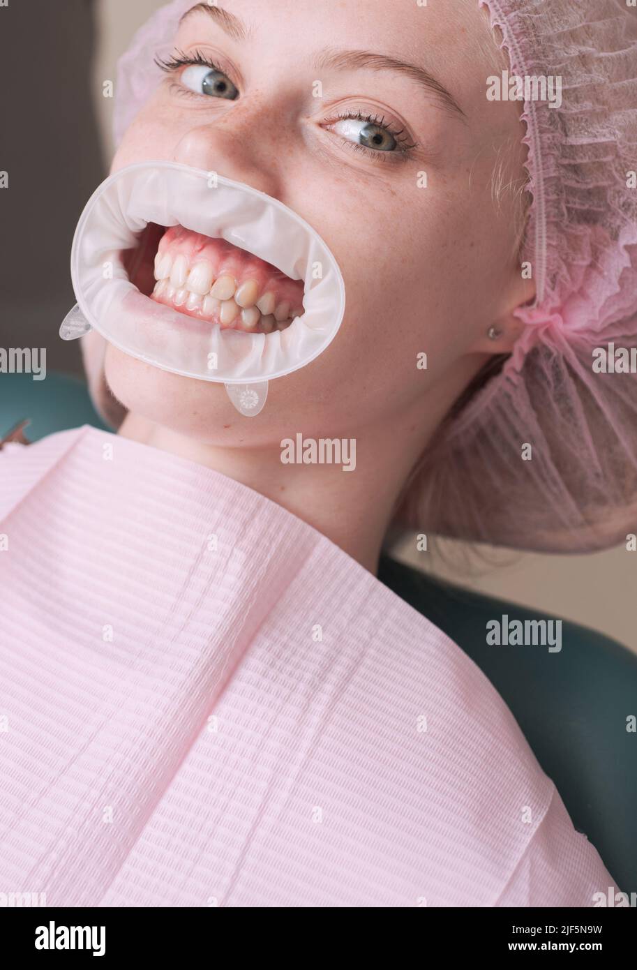 Une jeune femme blonde qui ouvre sa bouche alors qu'un dentiste non identifiable en gants de latex vérifie l'état de ses dents. Une femme heureuse souriant sur un résumé Banque D'Images