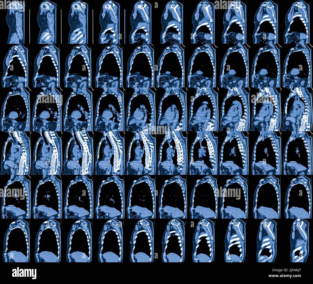 Imagerie par résonance magnétique (IRM) des organes thoraciques Banque D'Images