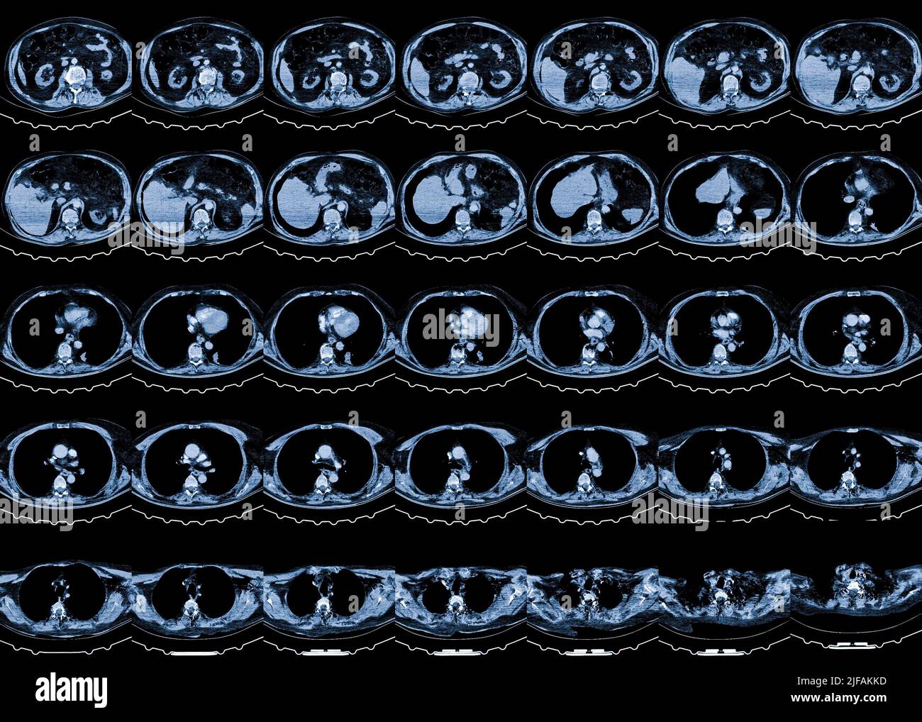 Imagerie par résonance magnétique (IRM) des organes thoraciques Banque D'Images