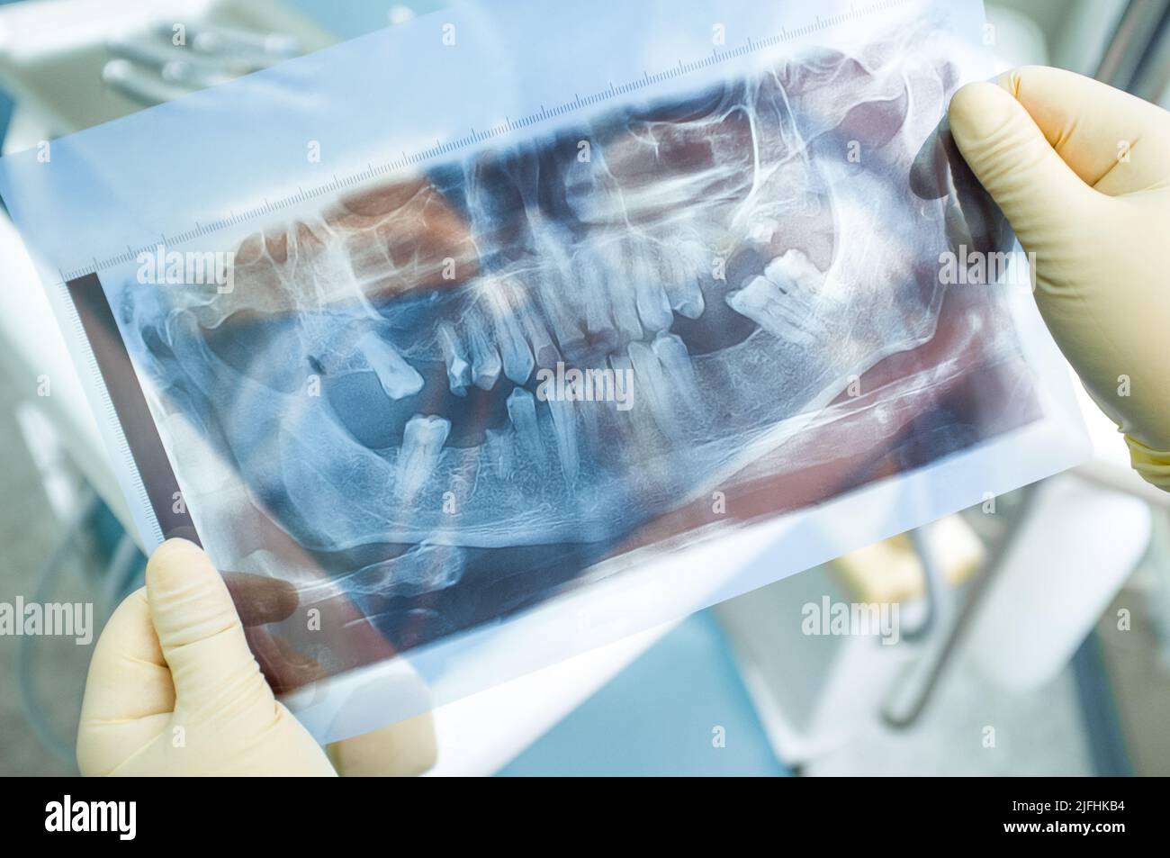 Image panoramique des dents humaines par rayons X. Banque D'Images