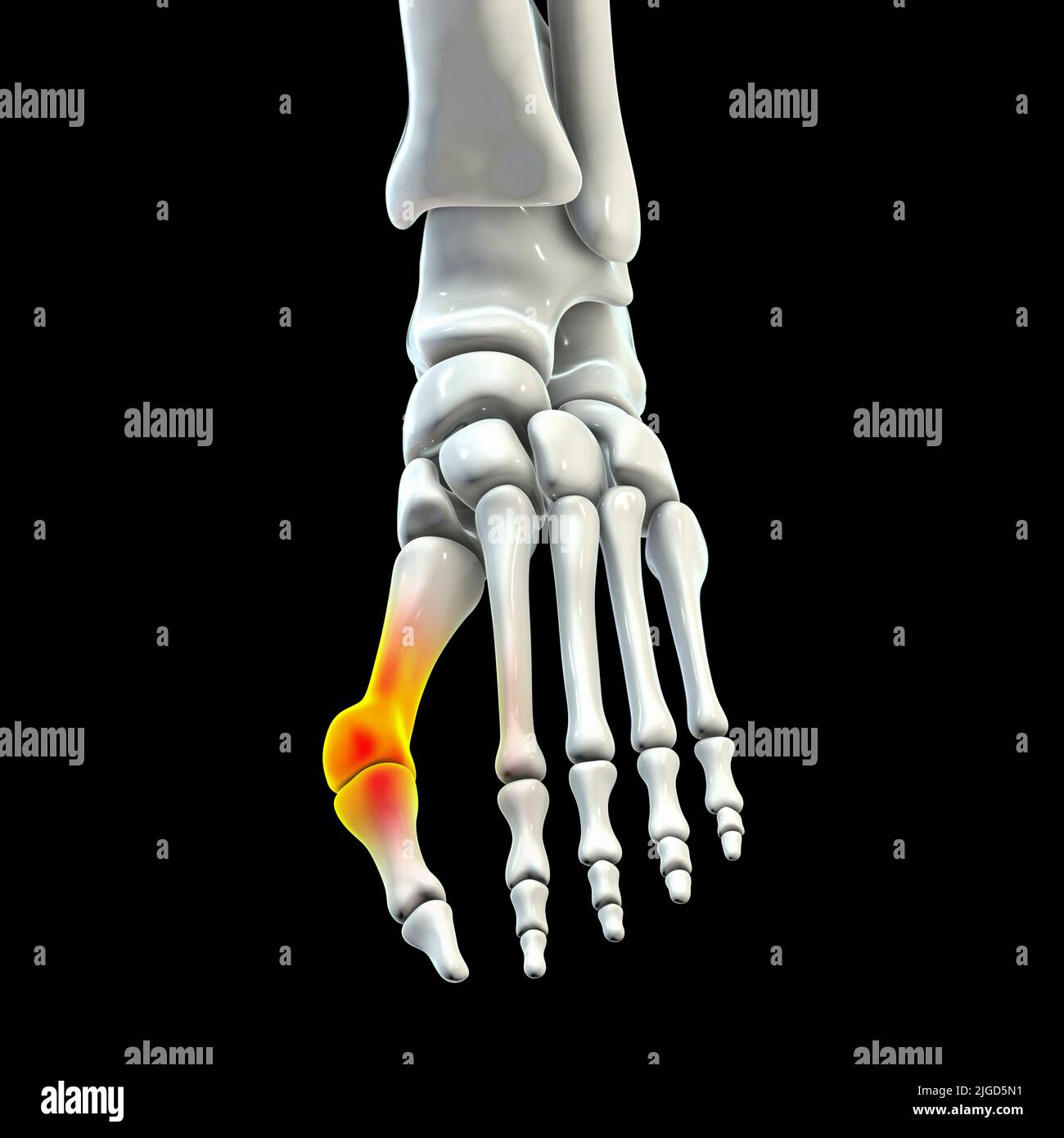 Articulation cartilagineuse Banque de photographies et d’images à haute