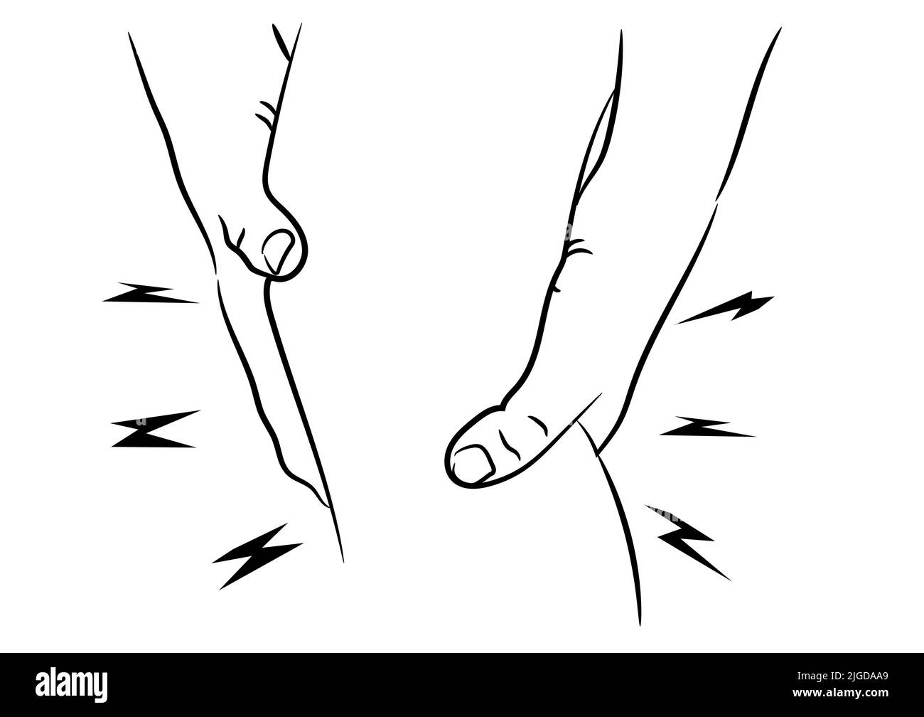 Articulation du Genou douloureux problèmes tendineux, gonflement après l'exercice d'illustration vectorielle Illustration de Vecteur