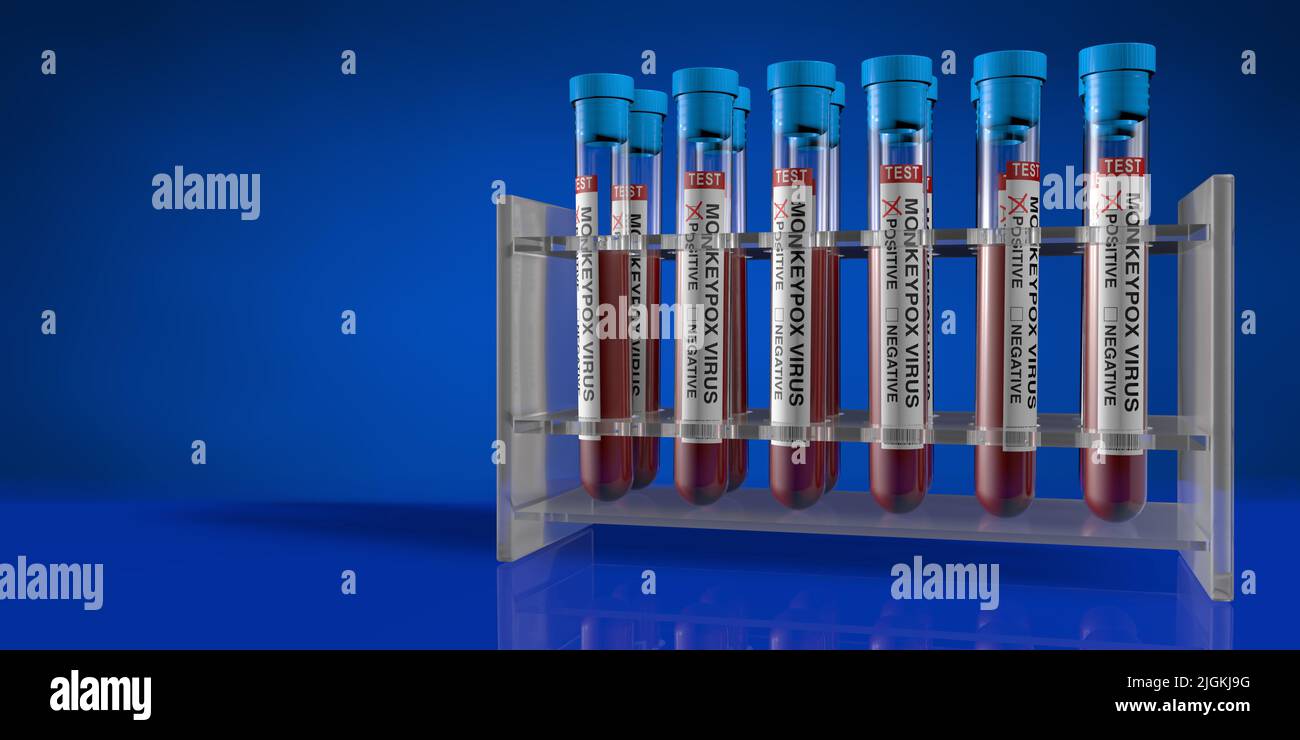 Groupe de tubes à essai dans le support sur la table réfléchissante avec des échantillons de sang positifs pour la varicelle sur fond bleu foncé. 3D Illustration Banque D'Images