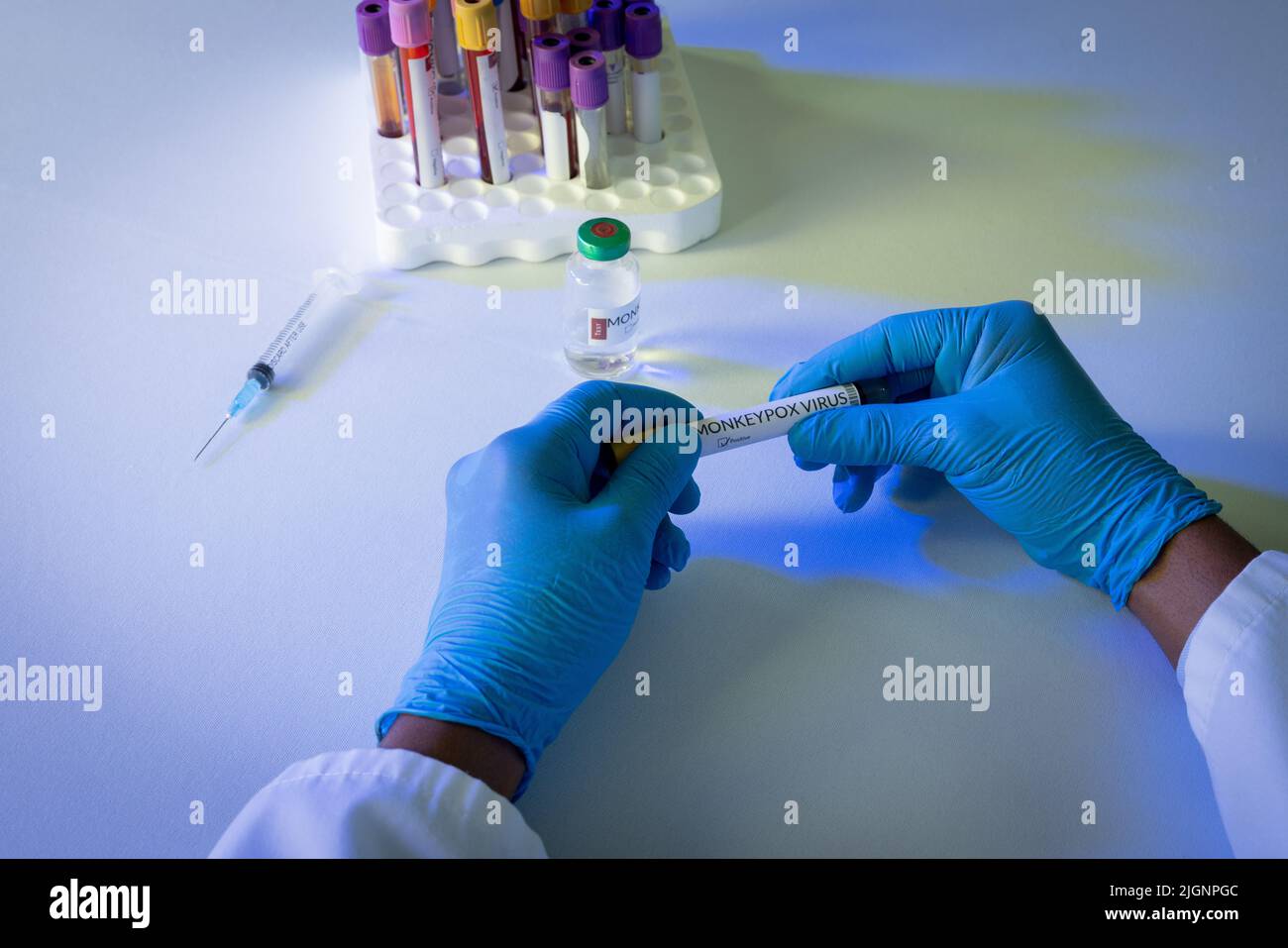 Mains du médecin tenant le flacon avec le virus de la variole du singe Banque D'Images