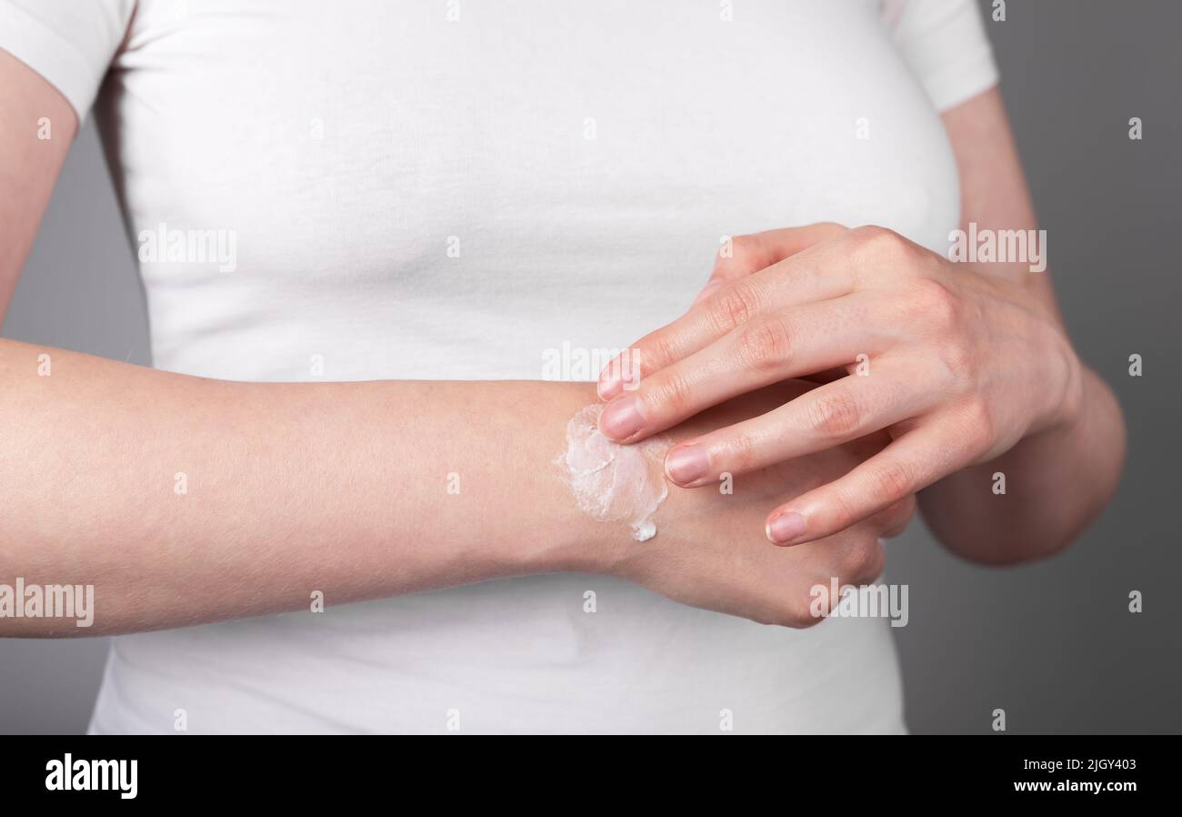 Femme appliquant du gel de soulagement de la douleur sur le poignet entorgé pour l'enflure et la réduction de l'inflammation. Lésion du bras, maladie chronique. Concept de soins de santé. Photo de haute qualité Banque D'Images