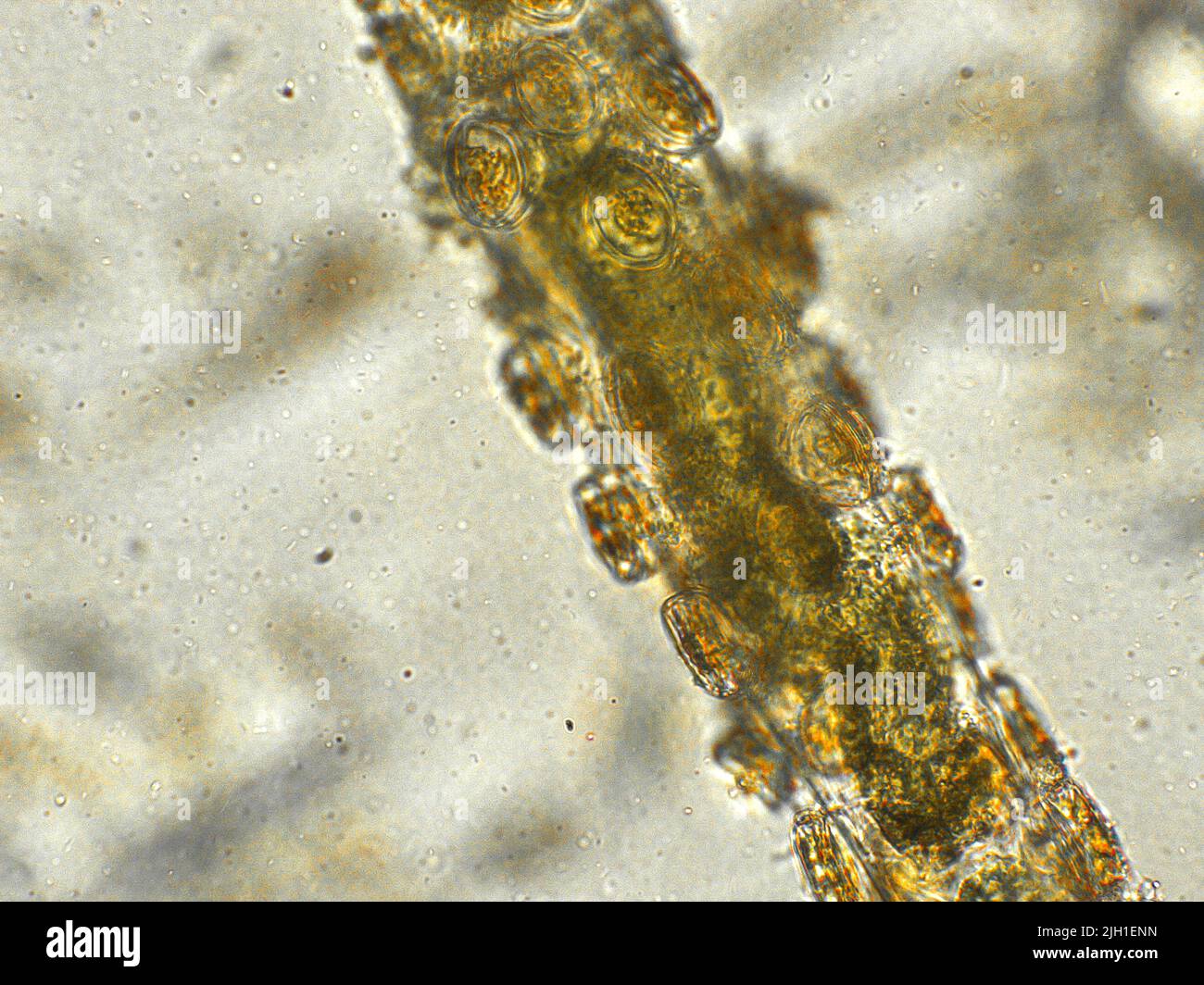Algues filamenteuses sous vue microscopique Banque D'Images