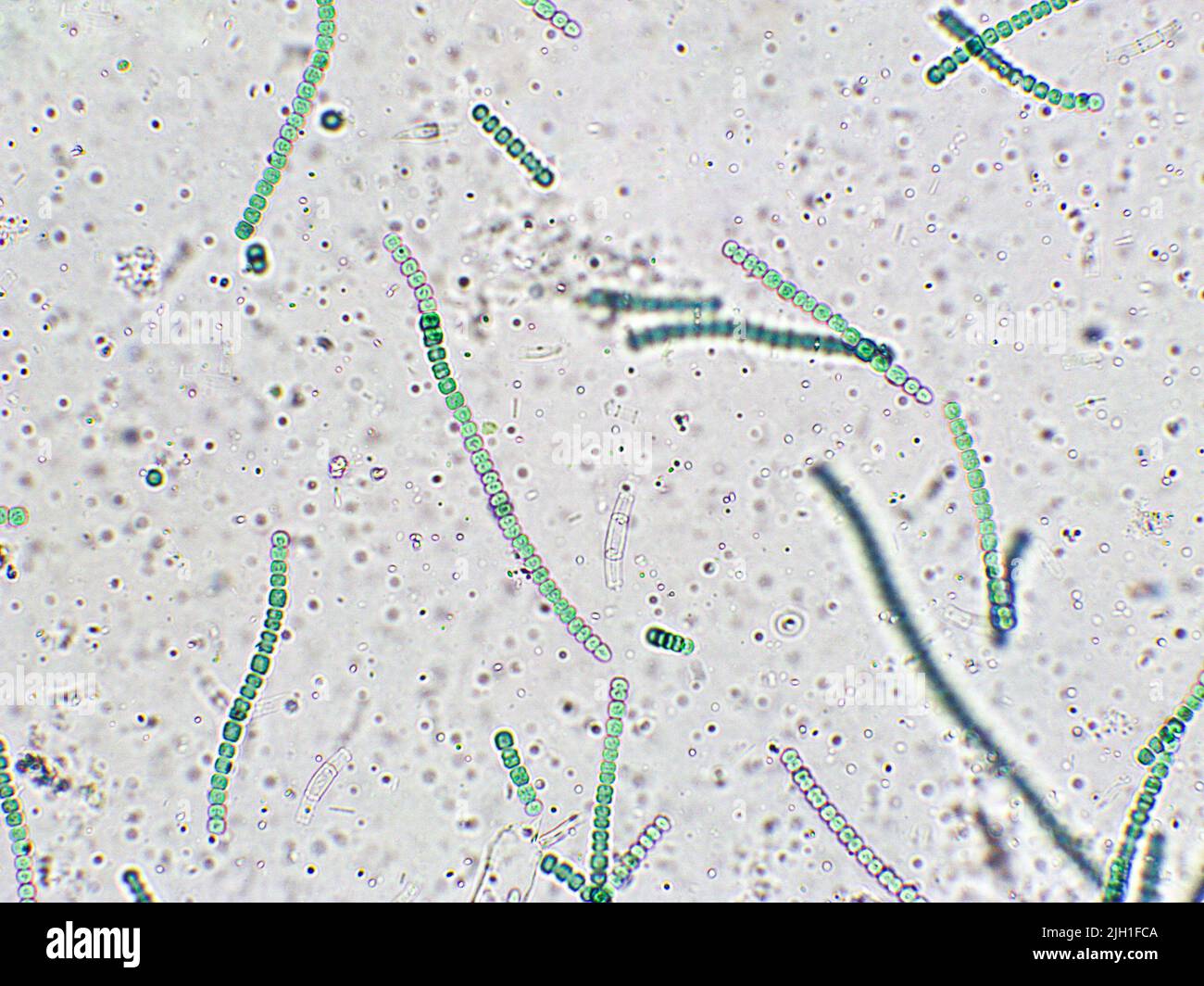 Algues bleues sous une vue microscopique, cyanobactéries Banque D'Images
