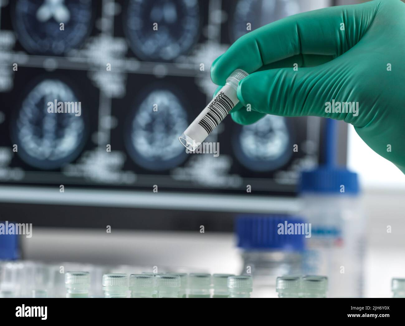 Recherche sur la maladie d'Alzheimer et la démence, image conceptuelle Banque D'Images