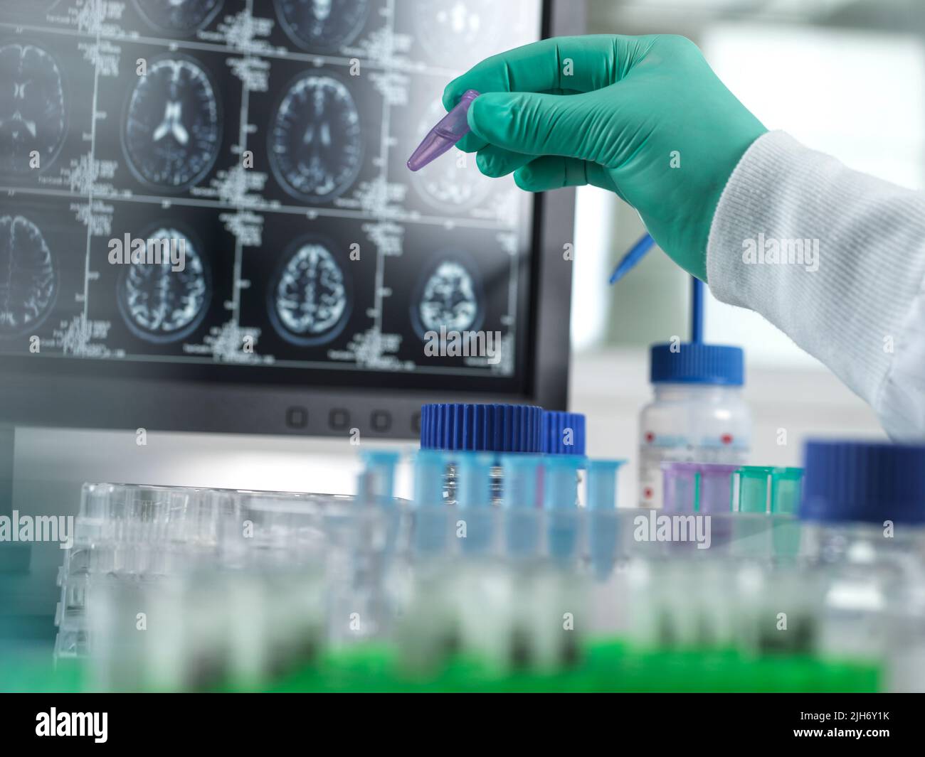 Recherche sur la maladie d'Alzheimer et la démence, image conceptuelle Banque D'Images