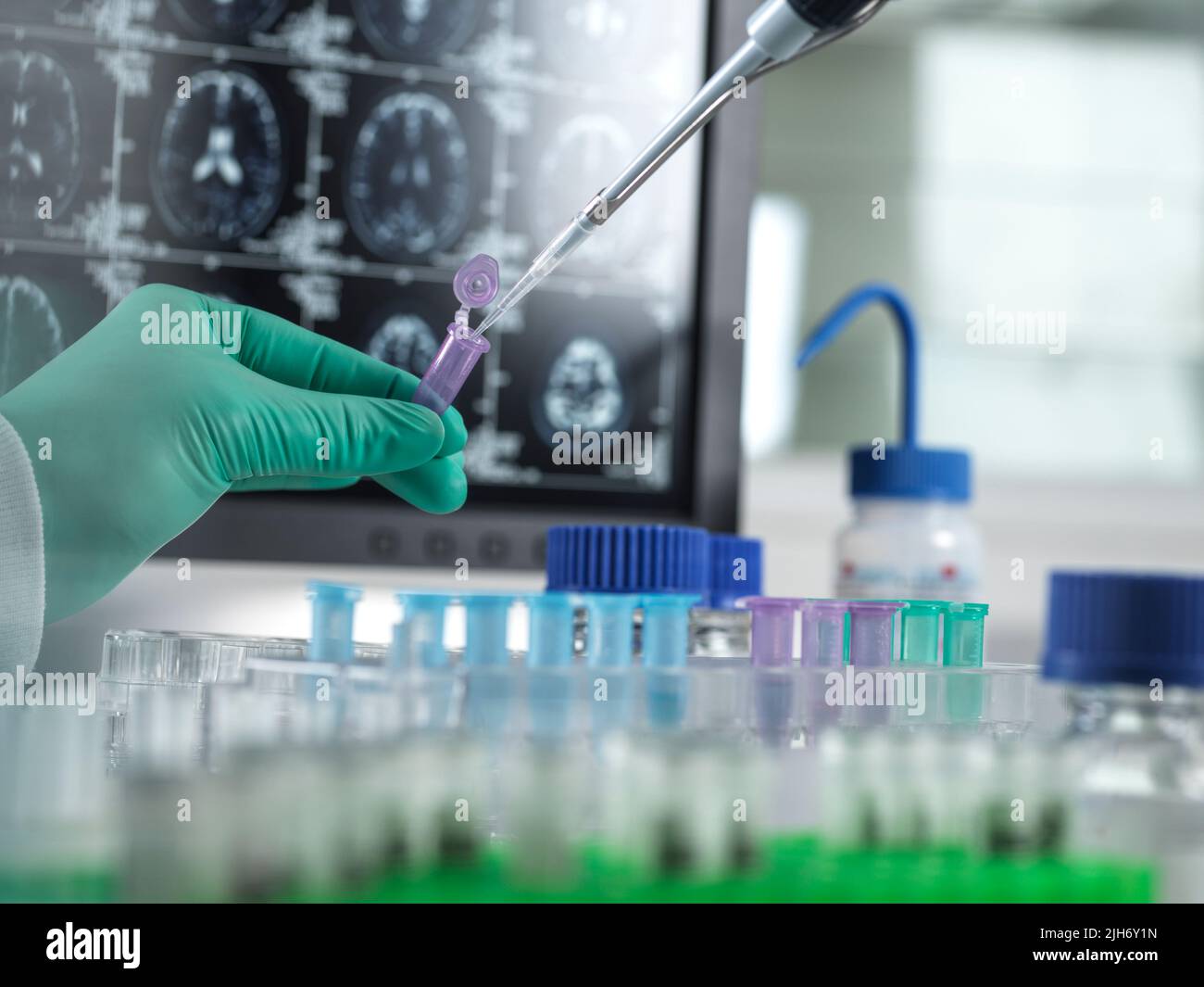 Recherche sur la maladie d'Alzheimer et la démence, image conceptuelle Banque D'Images