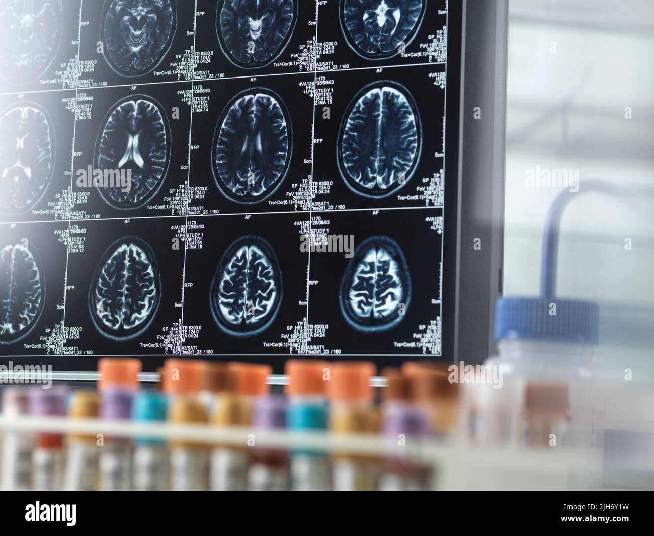 Recherche sur la maladie d'Alzheimer et la démence, image conceptuelle Banque D'Images