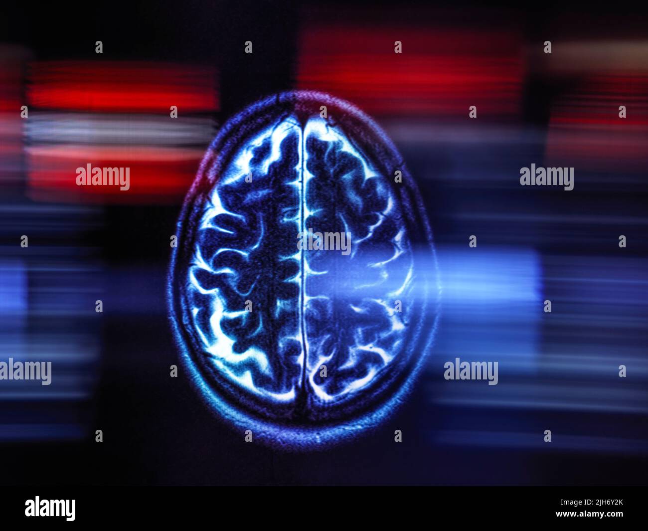Recherche sur la maladie d'Alzheimer et la démence, image conceptuelle Banque D'Images