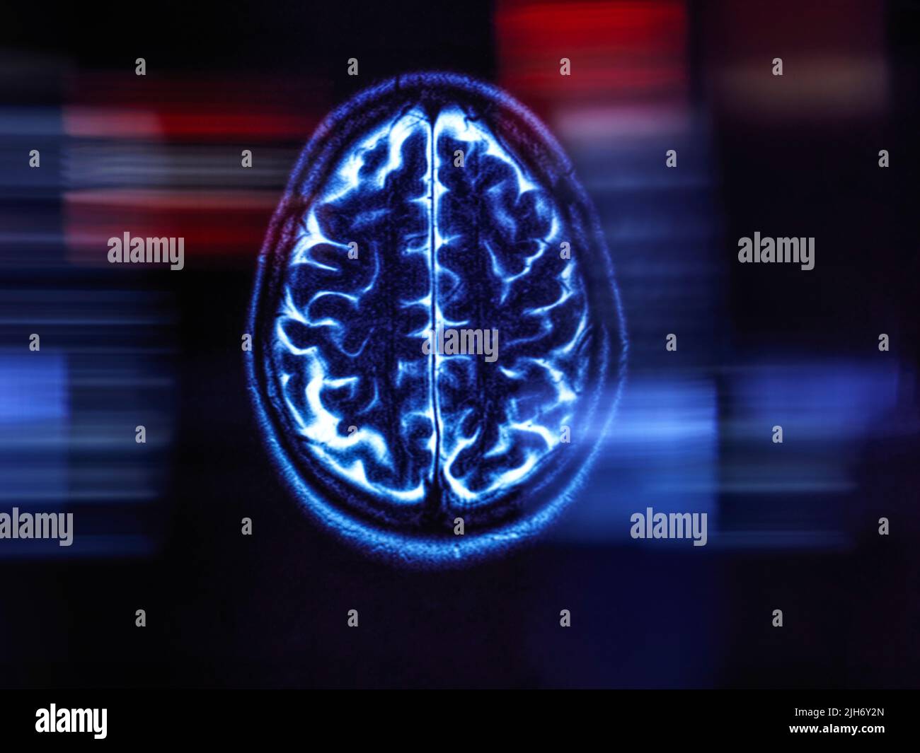 Recherche sur la maladie d'Alzheimer et la démence, image conceptuelle Banque D'Images
