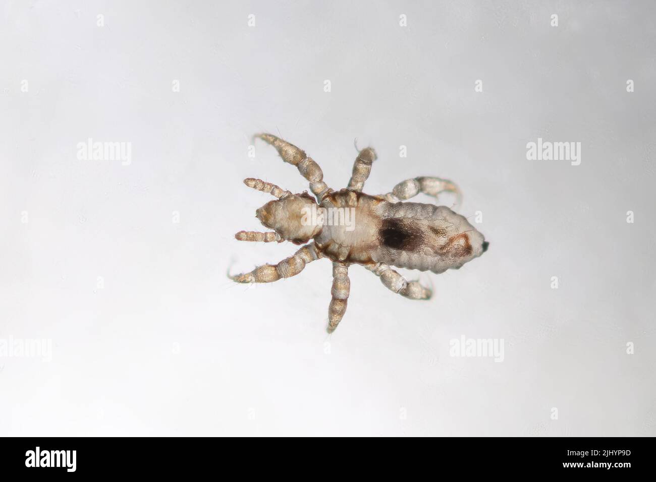 Nymfa de poux de tête, vraie photo macro extrême. Maladies infectieuses humaines. Pediculus capitis. Banque D'Images Nymfa de poux de tête, vraie photo macro extrême. Maladies infectieuses humaines. Pediculus capitis. Banque D'Images