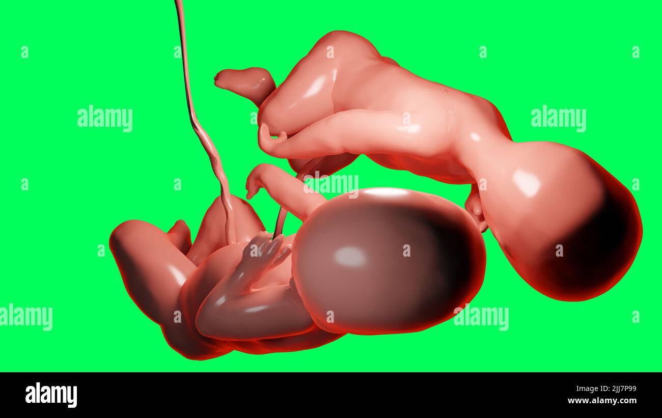 3D a rendu une illustration médicalement précise de jumeaux dans l'utérus, de jumeaux monozygotiques dans l'utérus avec un placenta unique, de fœtus jumeaux humains, de gréwi prénatal Banque D'Images