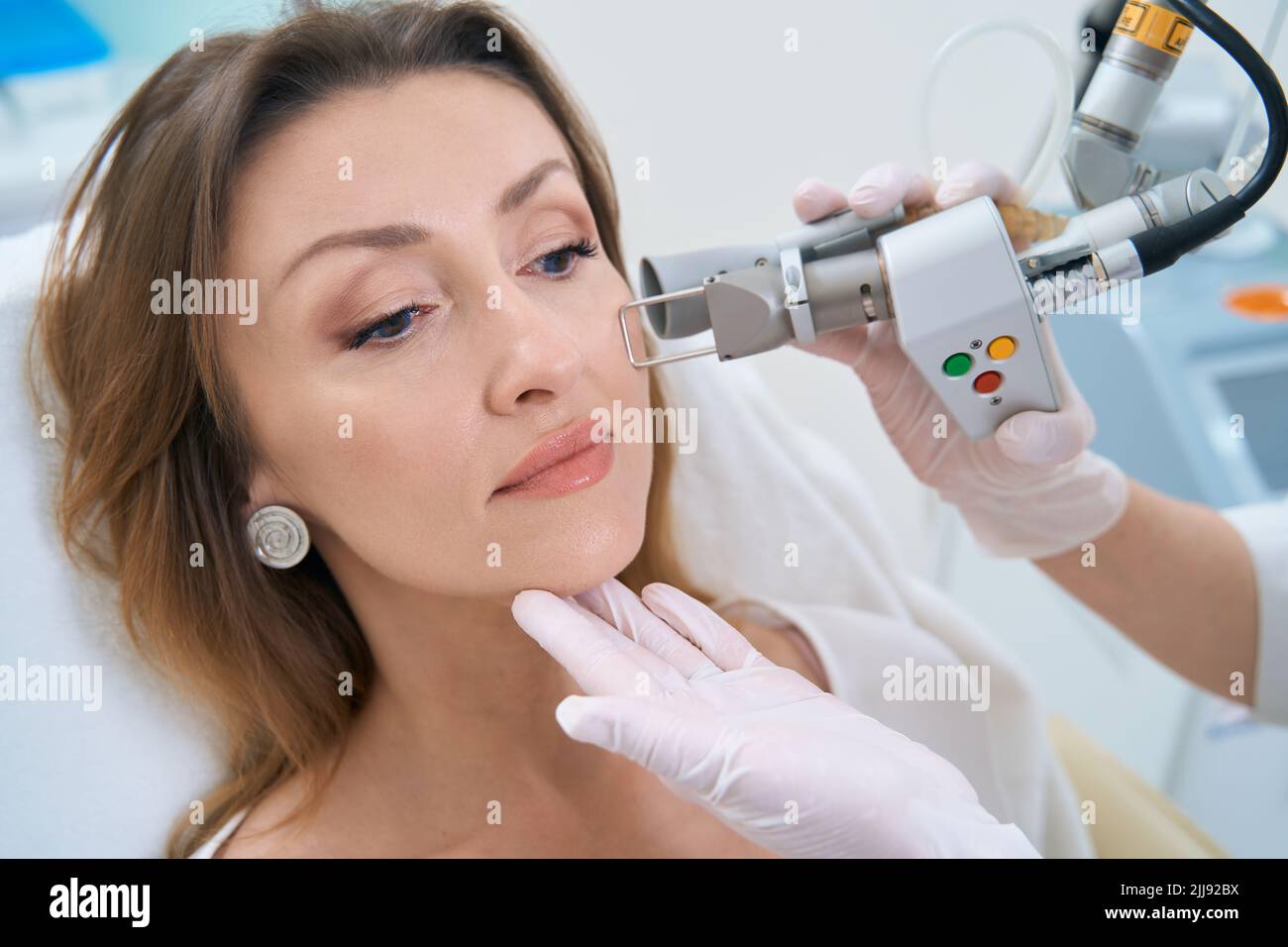Élimination au laser des néoplasmes pour éliminer les formations cutanées sur le visage Banque D'Images