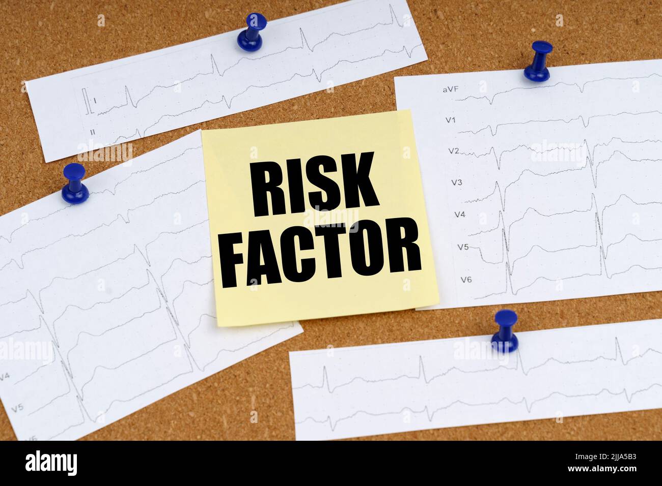 Médecine et concept de santé. Des coupures de cardiogramme et un autocollant portant l'inscription - FACTEUR DE RISQUE sont fixés à la carte Banque D'Images
