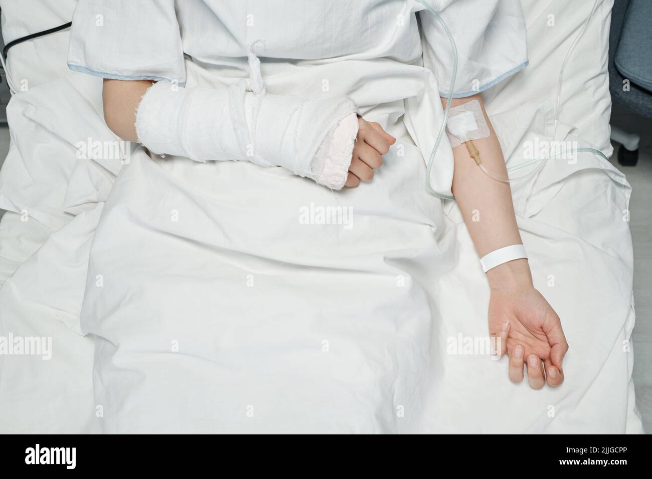 Injection horizontale de haut en bas d'une patiente présentant un bras cassé recevant des médicaments ou des liquides nutritifs par voie intraveineuse Banque D'Images