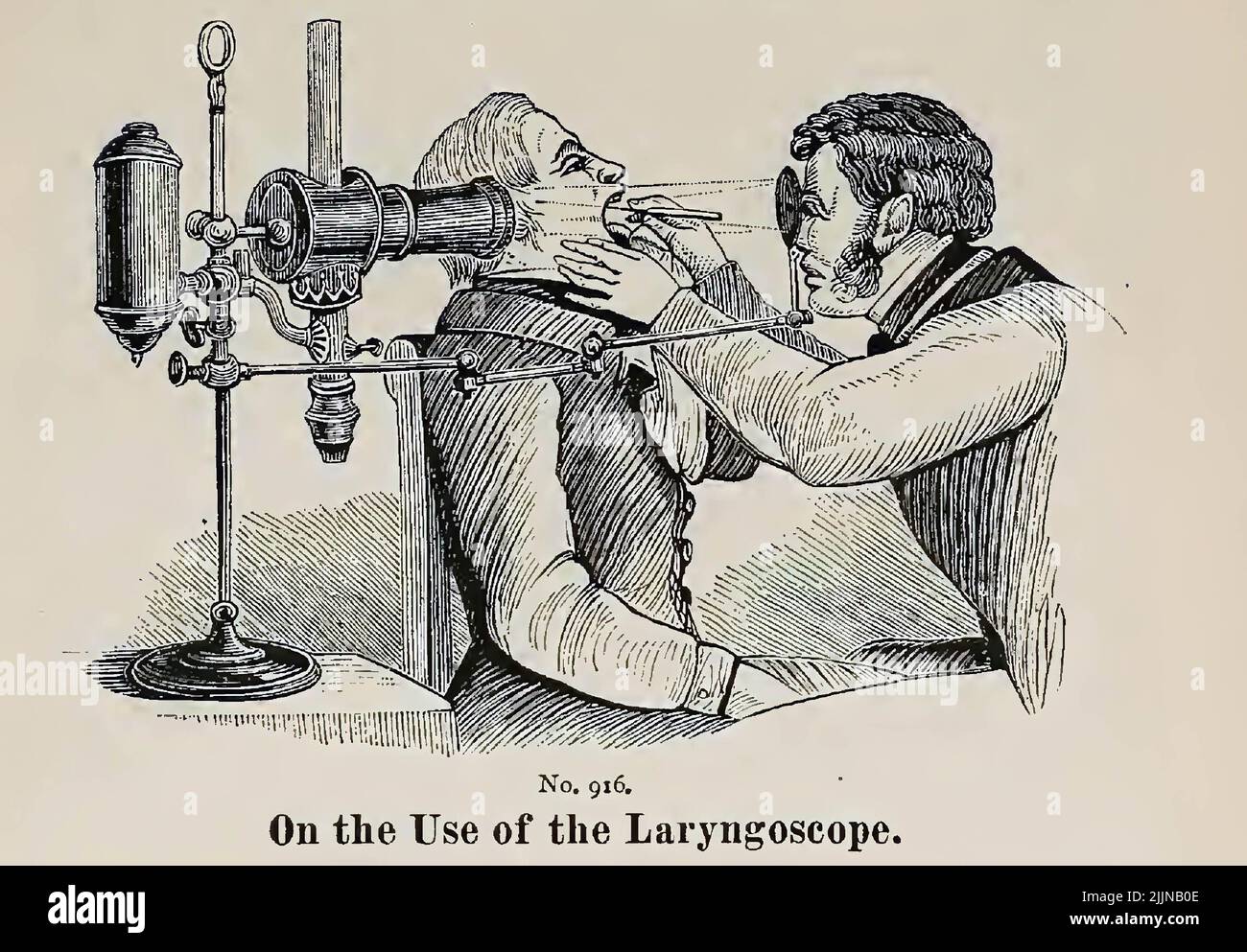 L'illustration d'un laryngoscope vintage datant de 19th ans. Banque D'Images