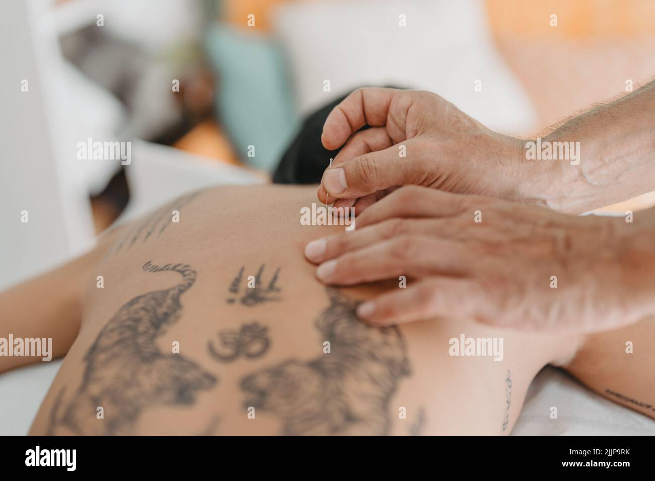 détail d'une aiguille d'acupuncture coincée dans un patient Banque D'Images