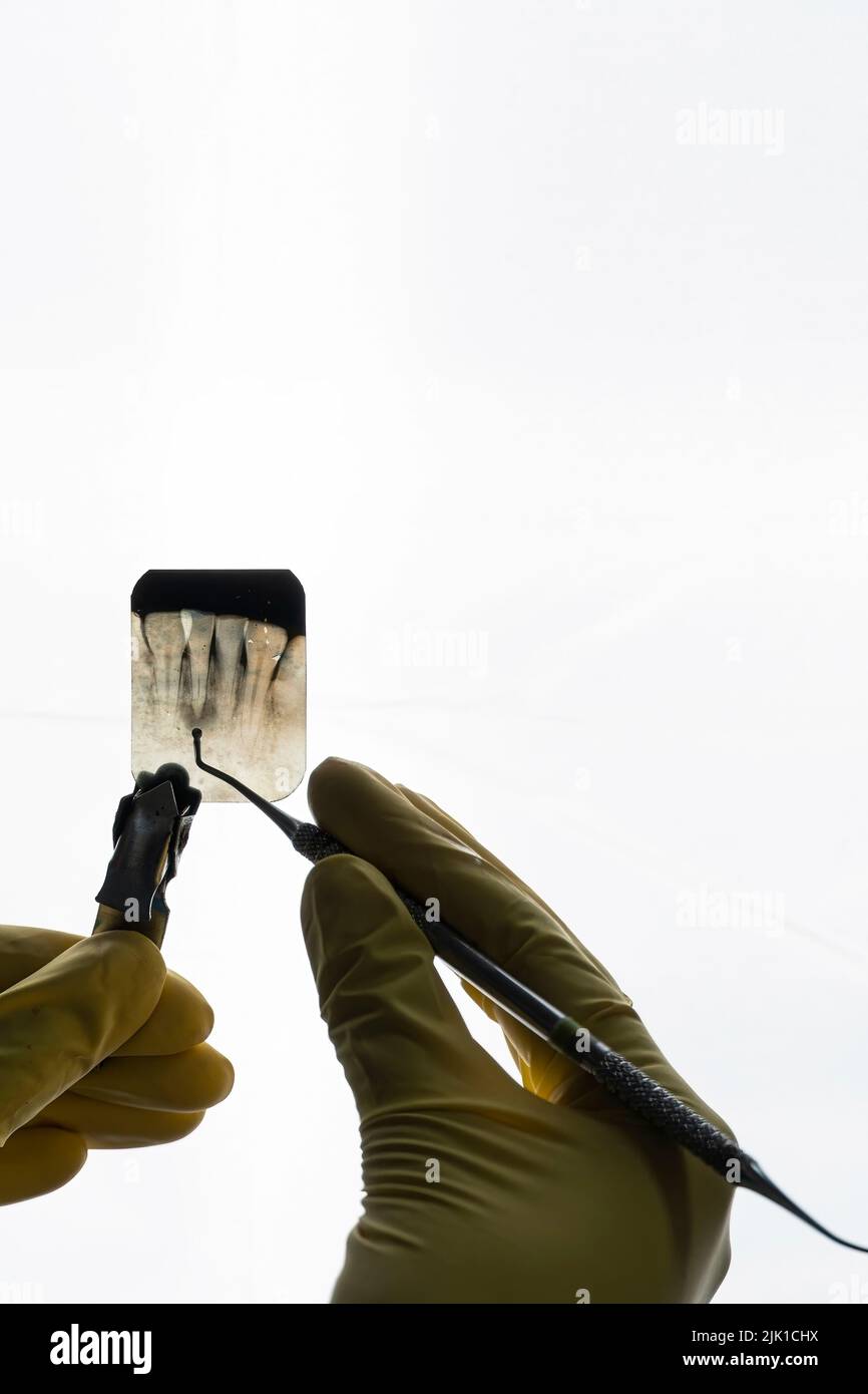 le dentiste tenant une radiographie dentaire découpe isolée sur fond blanc Banque D'Images