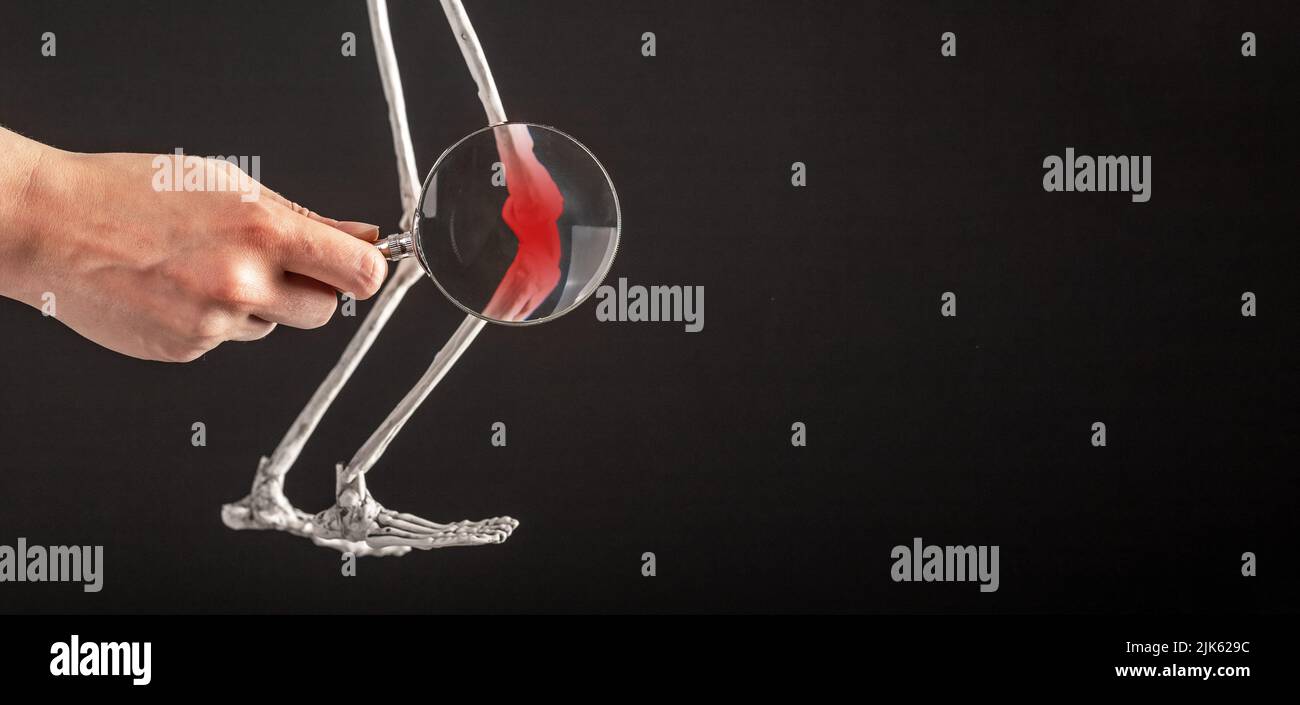 Bannière avec main avec loupe sur patella de squelette humain avec point rouge. Douleurs au genou. Ligaments tentainés, déchirure du ménisque, tendinite, luxation. Copier l'espace. Photo de haute qualité Banque D'Images