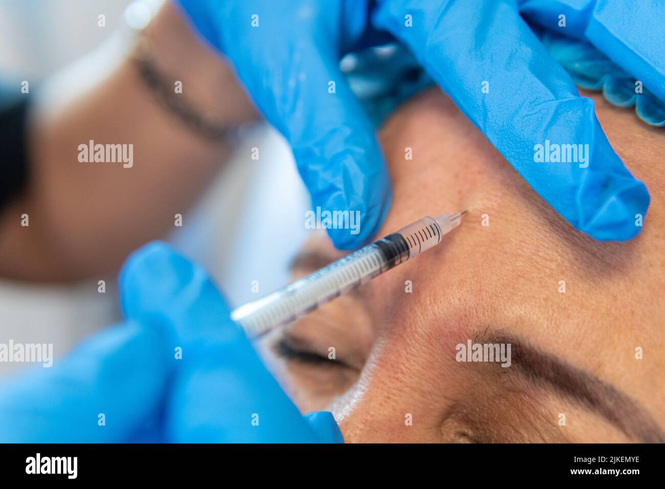 Gros plan des mains d'un médecin avec des gants injectés avec une seringue d'acide hyaluronique sur le front d'un patient. Traitement pour combler les plis Banque D'Images