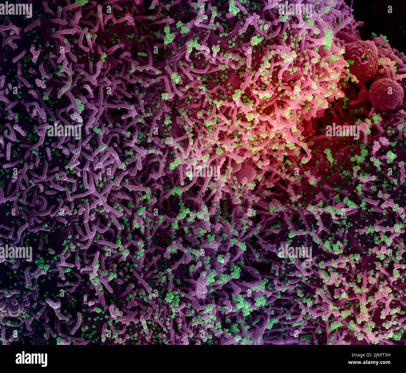 Micrographe électronique à balayage colorisé d'une cellule infectée par une souche variante de particules du virus du SRAS-COV-2, isolée d'un échantillon de patient. Image demandée au NIAID Integrated Research Facility (IRF) de fort Detrick, Maryland. Crédit : NIAID Banque D'Images