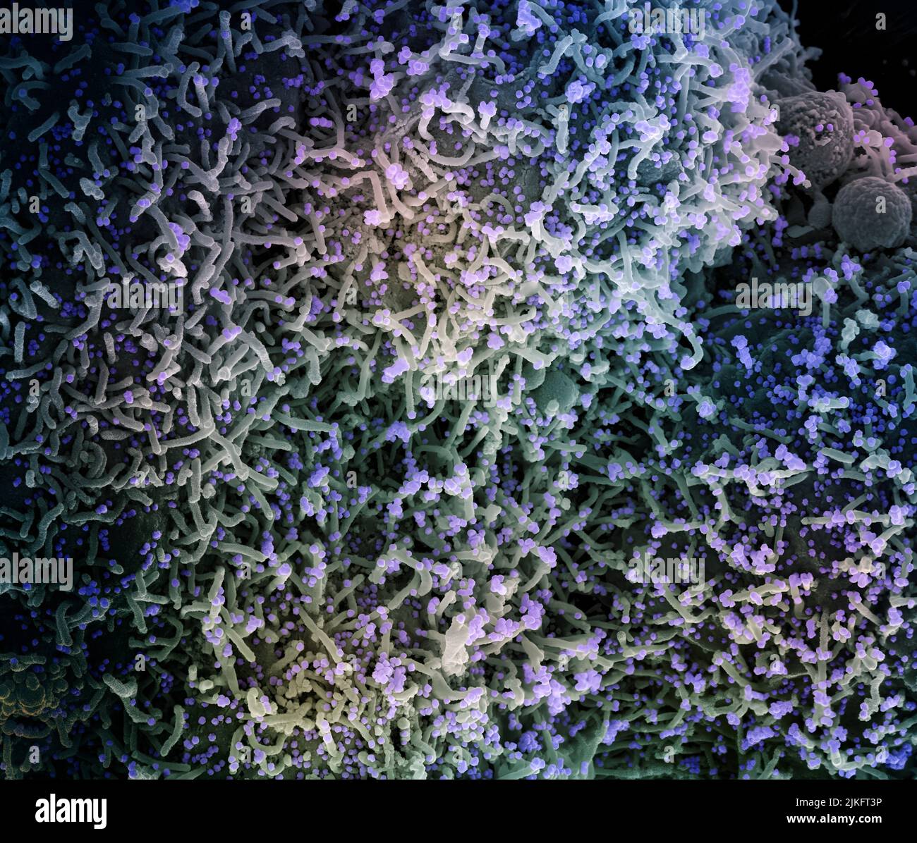 Micrographe électronique à balayage colorisé d'une cellule infectée par une souche variante de particules du virus du SRAS-COV-2, isolée d'un échantillon de patient. Image demandée au NIAID Integrated Research Facility (IRF) de fort Detrick, Maryland. Crédit : NIAID Banque D'Images