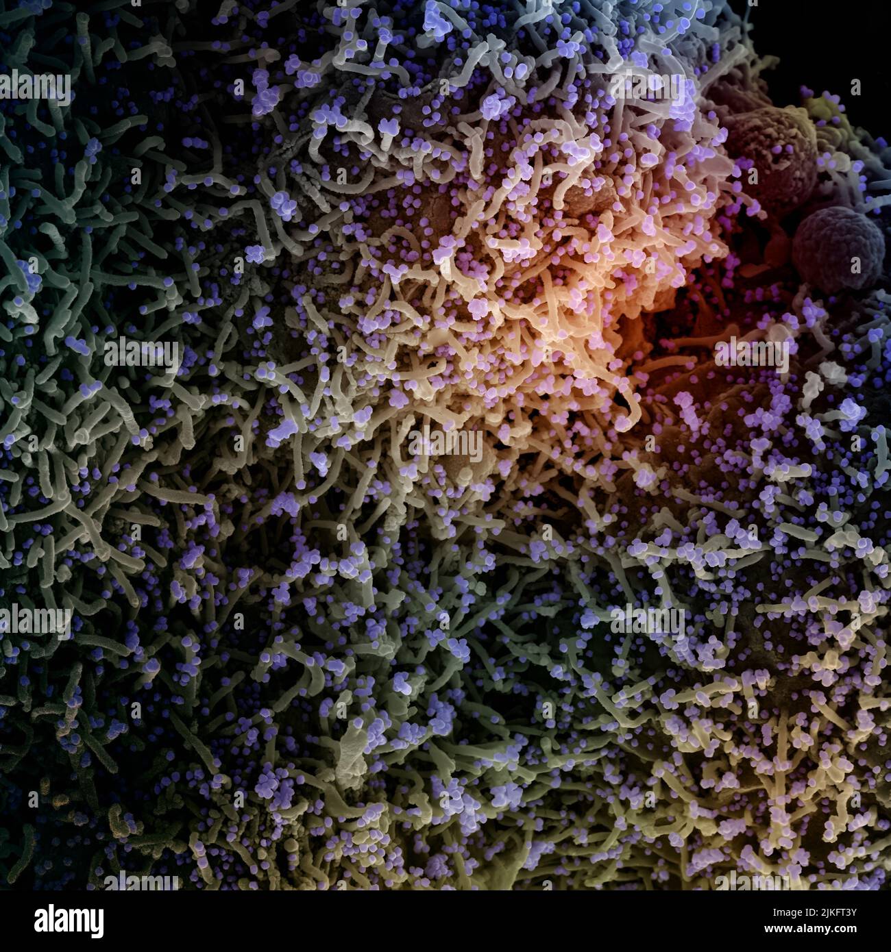 Micrographe électronique à balayage colorisé d'une cellule infectée par une souche variante de particules du virus du SRAS-COV-2, isolée d'un échantillon de patient. Image demandée au NIAID Integrated Research Facility (IRF) de fort Detrick, Maryland. Crédit : NIAID Banque D'Images