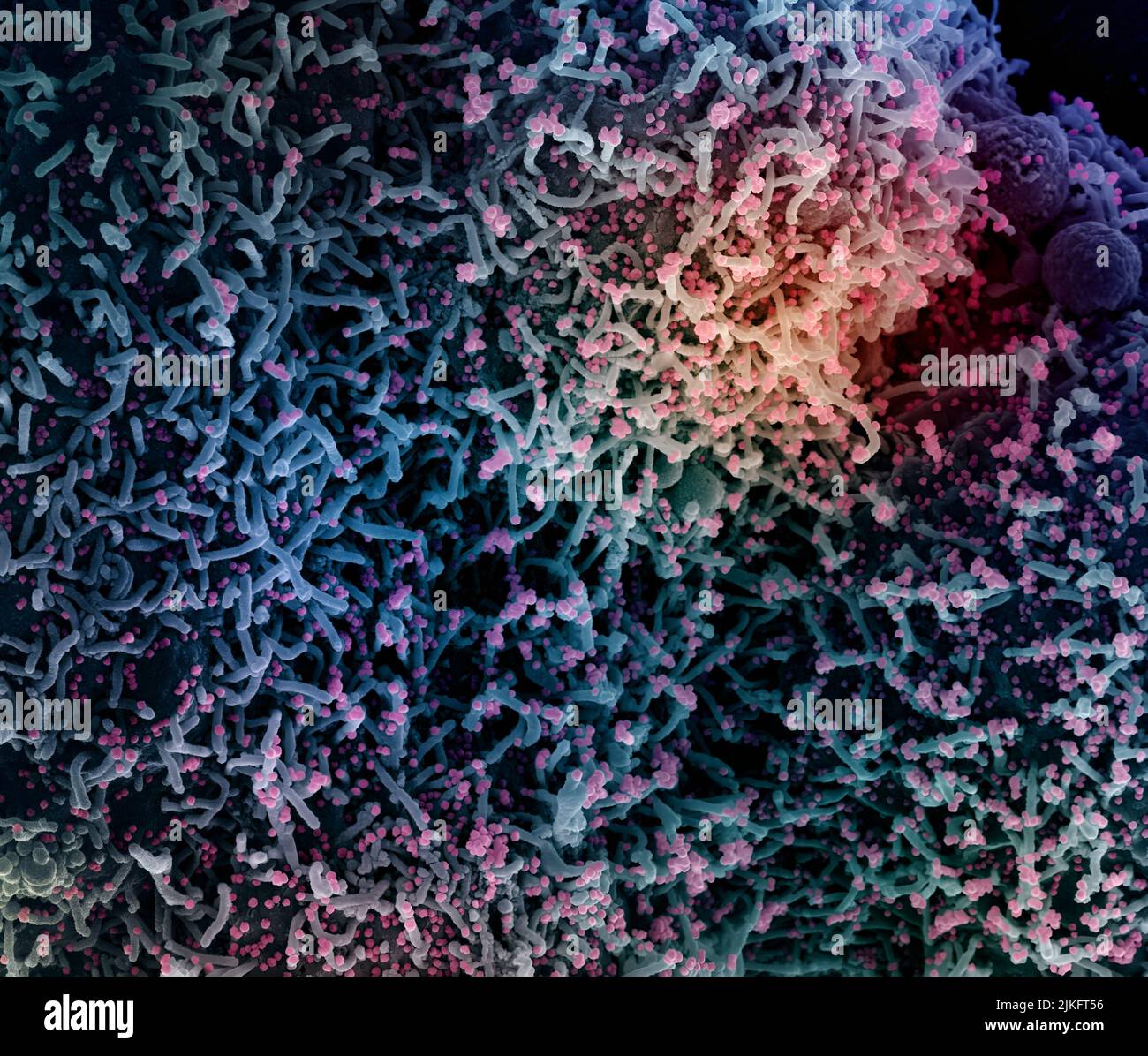 Micrographe électronique à balayage colorisé d'une cellule infectée par une souche variante de particules du virus du SRAS-COV-2, isolée d'un échantillon de patient. Image demandée au NIAID Integrated Research Facility (IRF) de fort Detrick, Maryland. Crédit : NIAID Banque D'Images