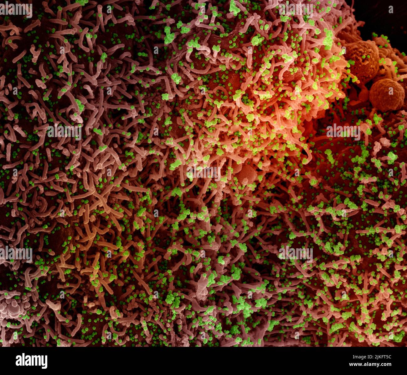 Micrographe électronique à balayage colorisé d'une cellule infectée par une souche variante de particules du virus du SRAS-COV-2, isolée d'un échantillon de patient. Image demandée au NIAID Integrated Research Facility (IRF) de fort Detrick, Maryland. Crédit : NIAID Banque D'Images